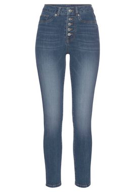 LASCANA High-waist-Jeans mit sichtbarer Knopfleiste und Stretch-Anteil