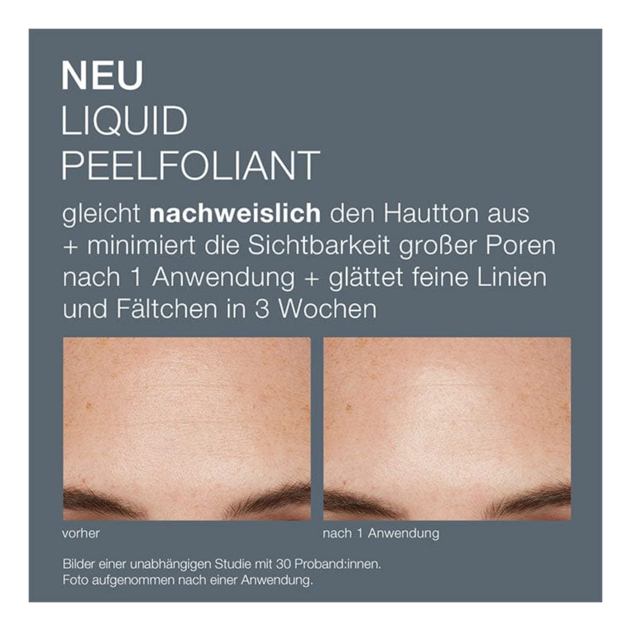 Dermalogica Gesichtspeeling Daily Skin Health Liquid Peelfoliant, für Alle Hauttypen