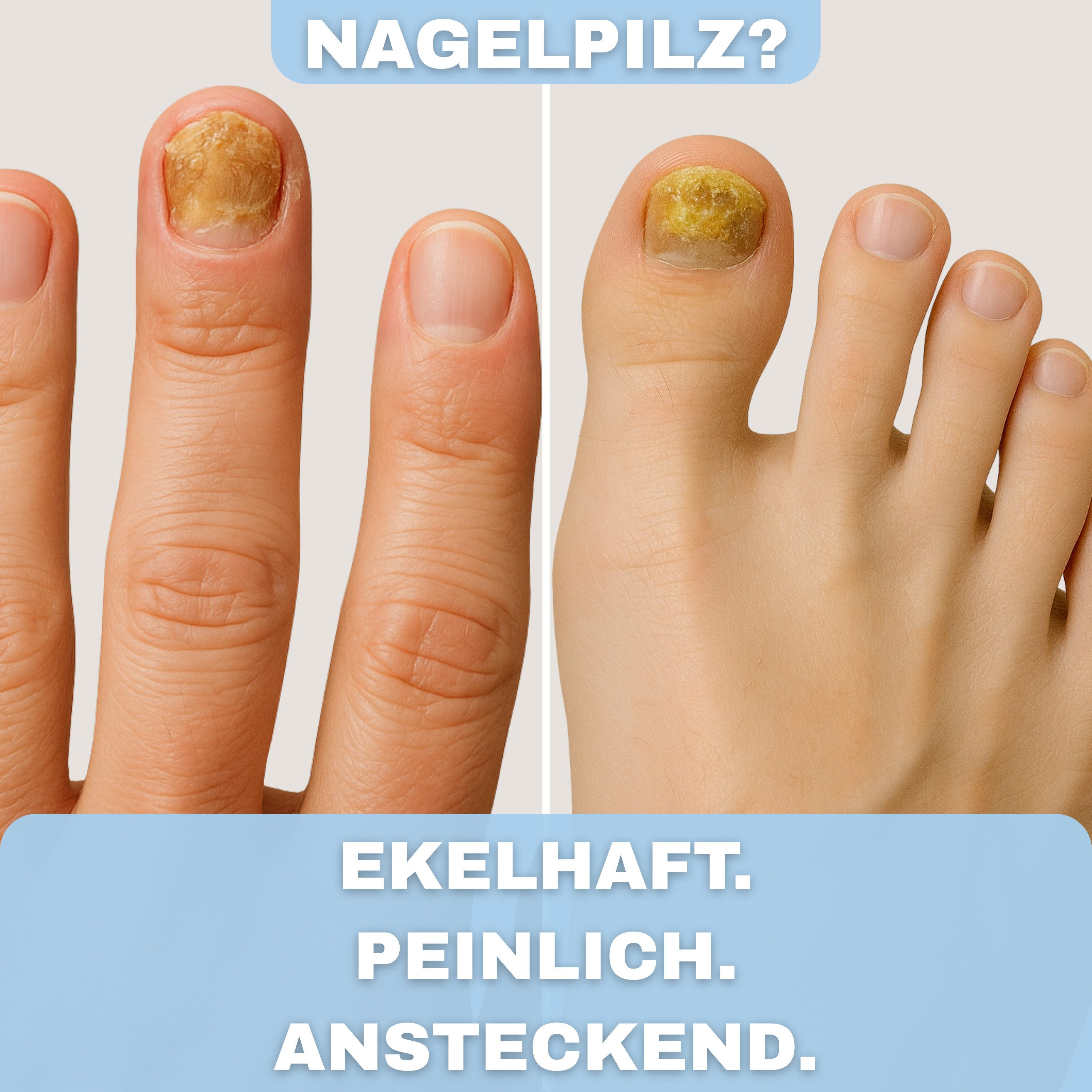 Health Press Nagelpflegestift Nagelpilzkur – Nagelpilz Lack, Medizinprodukt