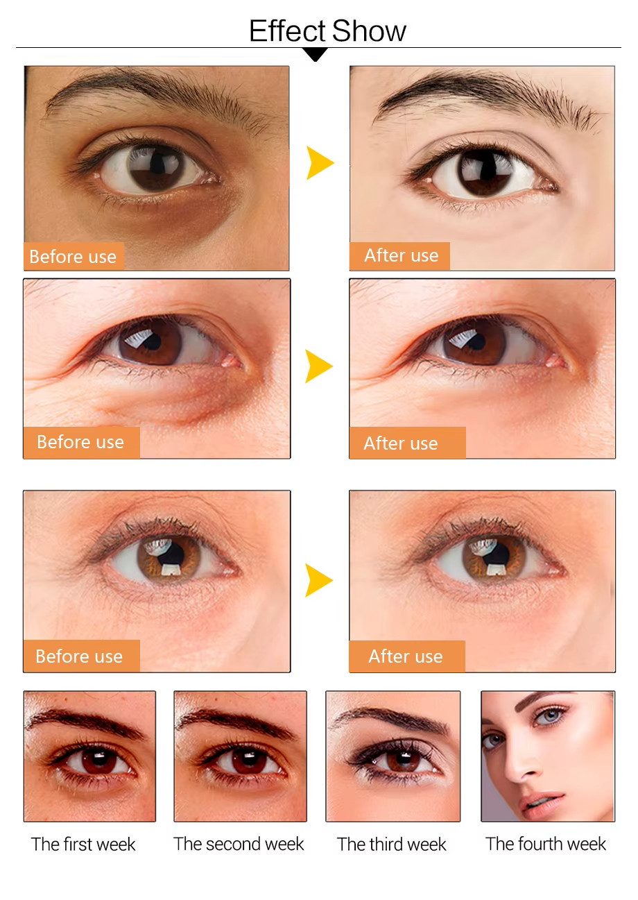 Athlix Gesichtsmaske 50 Paar Kollagen Augen Maske Hautpflege Anti-Aging Feuchtigkeit, 50-tlg., 50 Paar (100 Pads), Gel-Augenpads, Sanfte Pflege