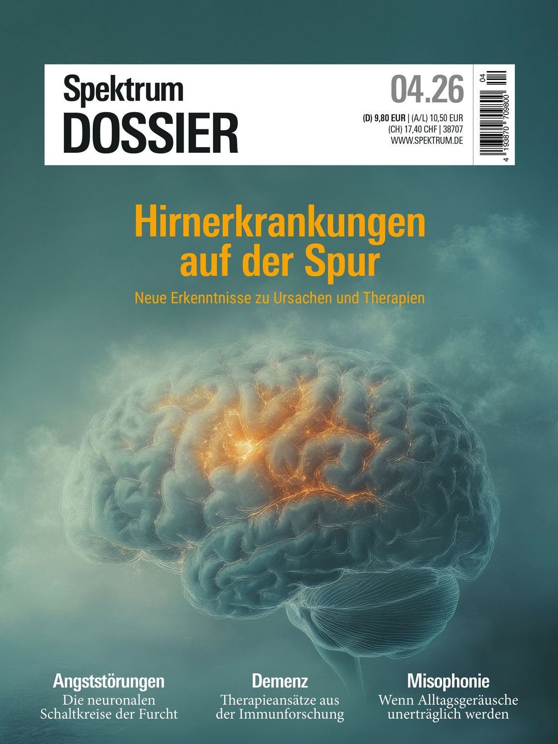 Spektrum Dossier 4/2026 Hirnerkrankungen auf der Spur / diverse