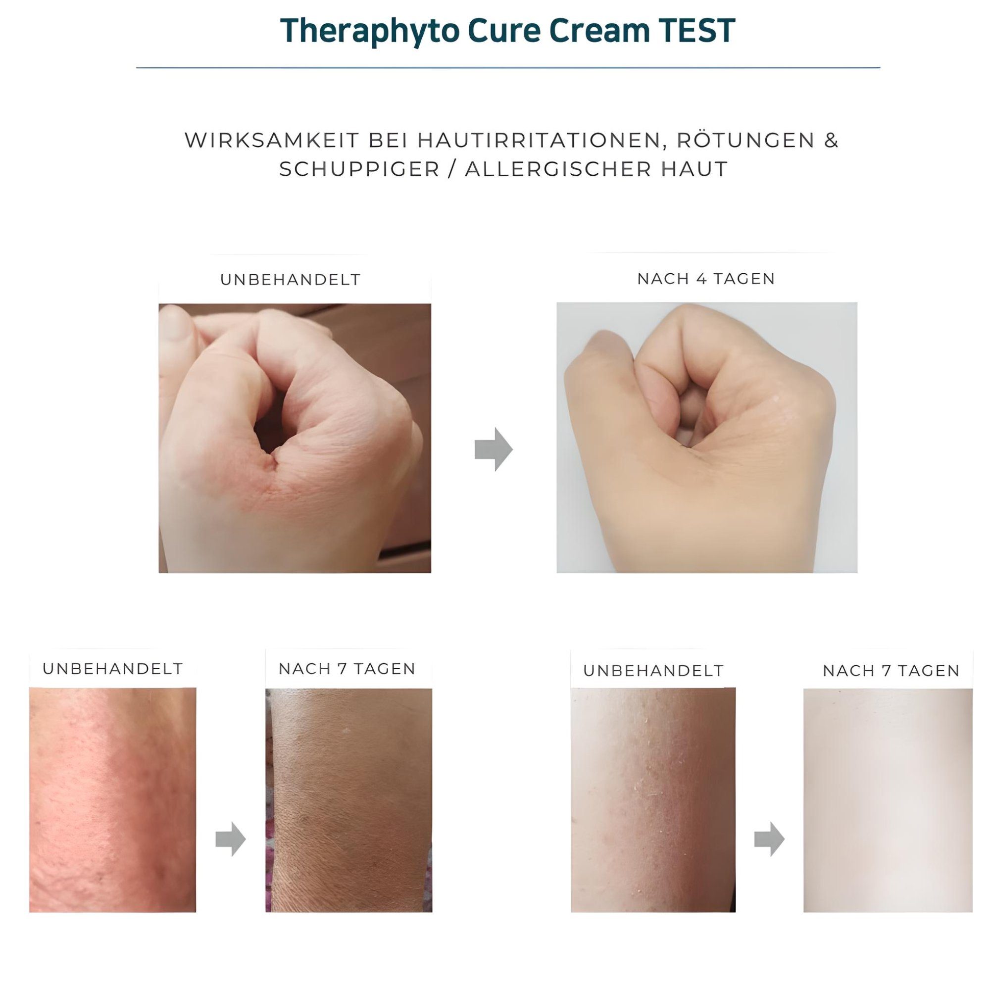 TheraphytoAbel Anti-Aging-Creme THERAPHYTO CURE CREAM