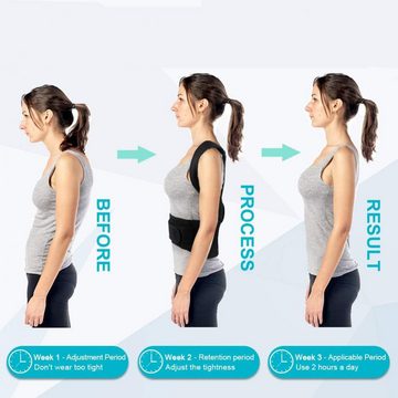 Lubgitsr Rückenstabilisator Schultergurt Haltungskorrektur, Rücken Geradehalter Haltungskorrektur (1-tlg)