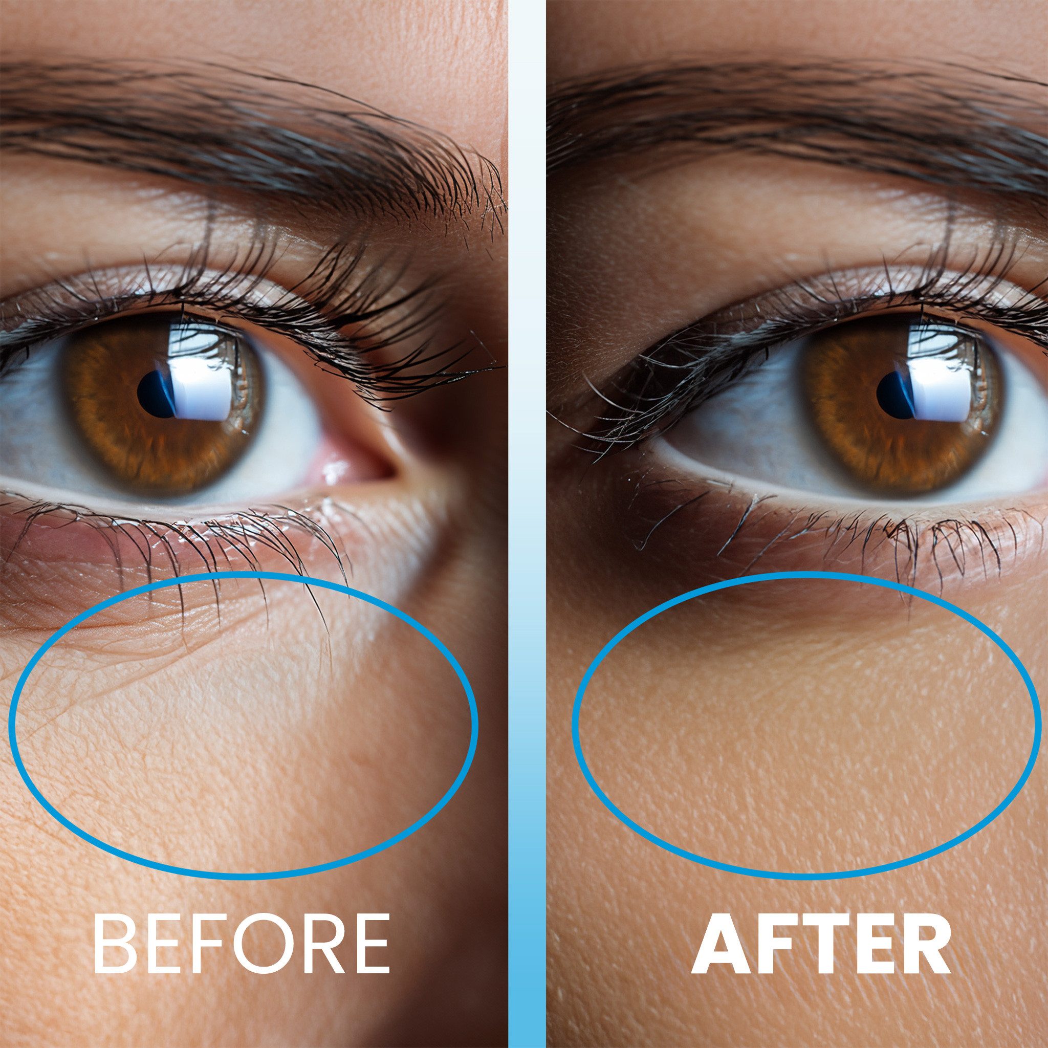 Newwell Augenserum Eis Therapie Roll-On - Anti-Falten Augenserum, 1-tlg., Anti-Falten, Anti-Augenringe, sofort Frische Effekt