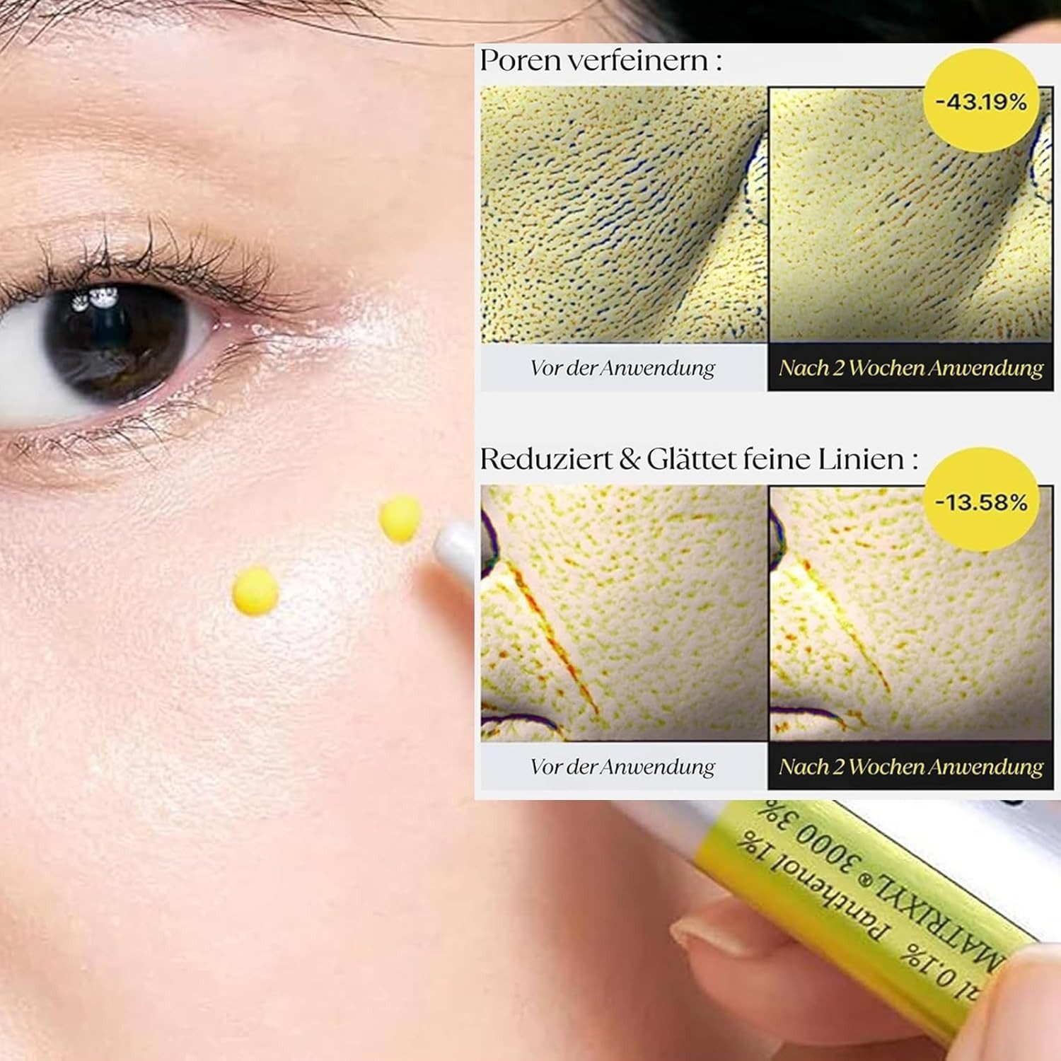 celimax Anti-Aging-Creme The Vita A Retinal Shot Straffungs-Booster mit Retinal 0,1%, Matryxyl 3%, Porenminimizer, Mehr als nur Anti‑Aging Ohne reizende Zusätze A‑Shot