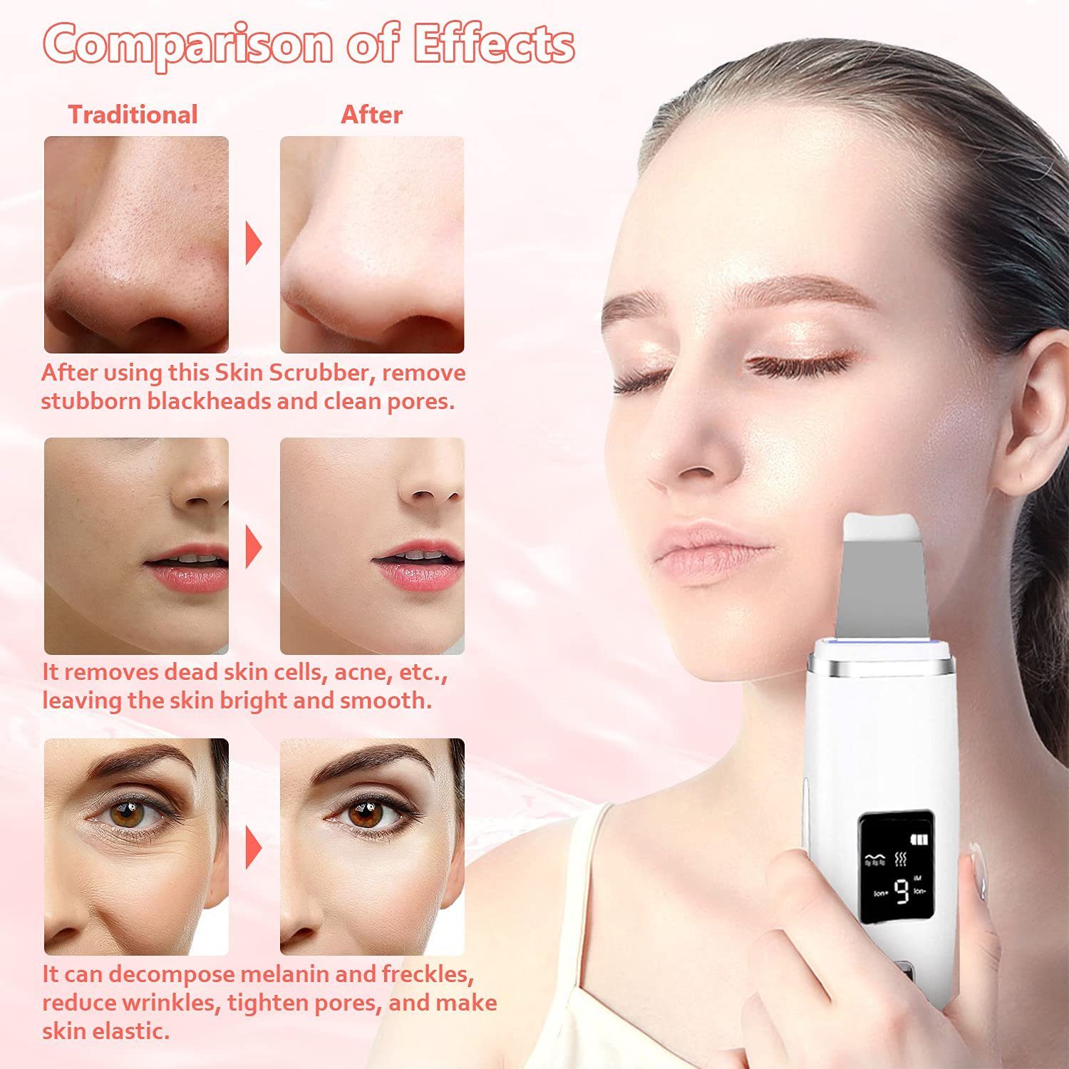 Remover, LCD Gesichtsbehörde Dermaroller für -Exfoliator Hautreinigungsgerät Ultraschall Haiaveng mit Ultraschallhaut -Display -Scrubber Blackhead