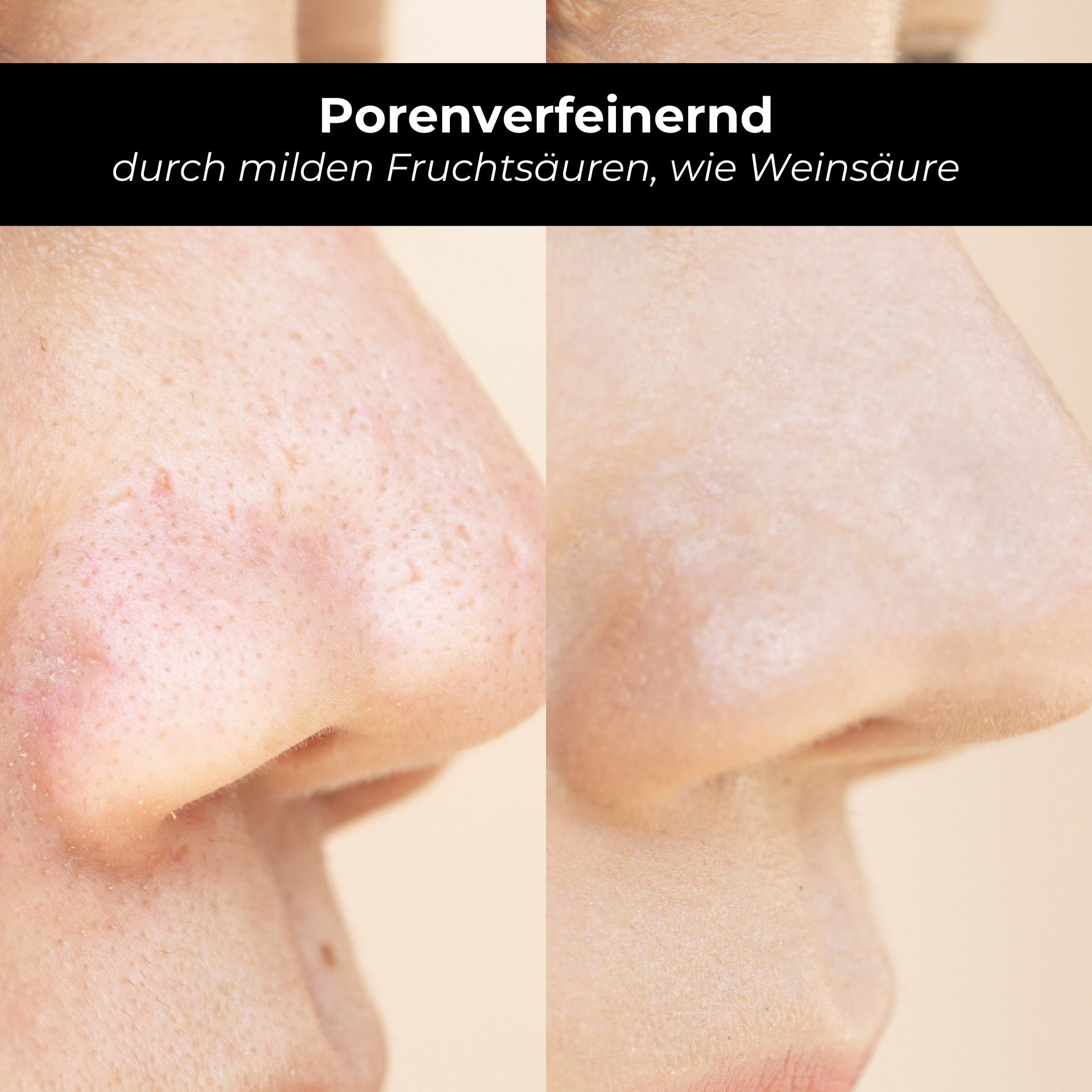 RAU Cosmetics Gesichtswasser AHA Fruchtsäure Gesichtsreinigung - Toner gegen Unreinheiten & Poren, Gesichtsreinigung