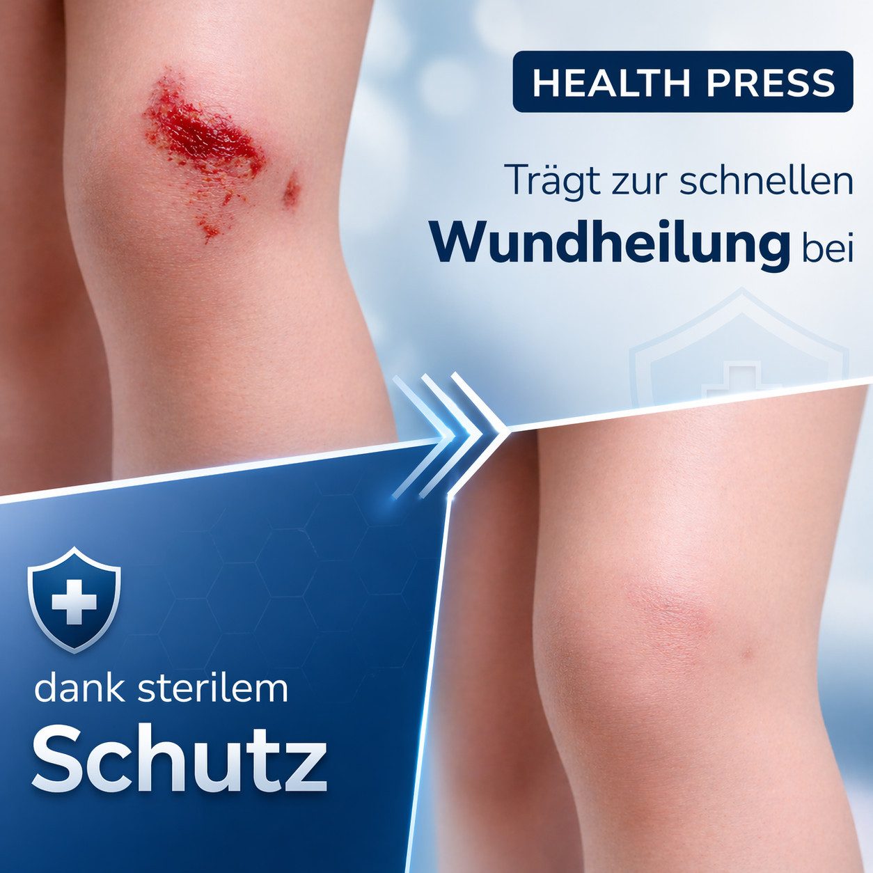 Health Press Wundpflaster steril - große Pflaster zur Wundversorgung (25 St., 50 Stück 6x7cm, 25 Stück 9x10cm, 25 Stück 9x15cm), Derma-Test: SEHR GUT