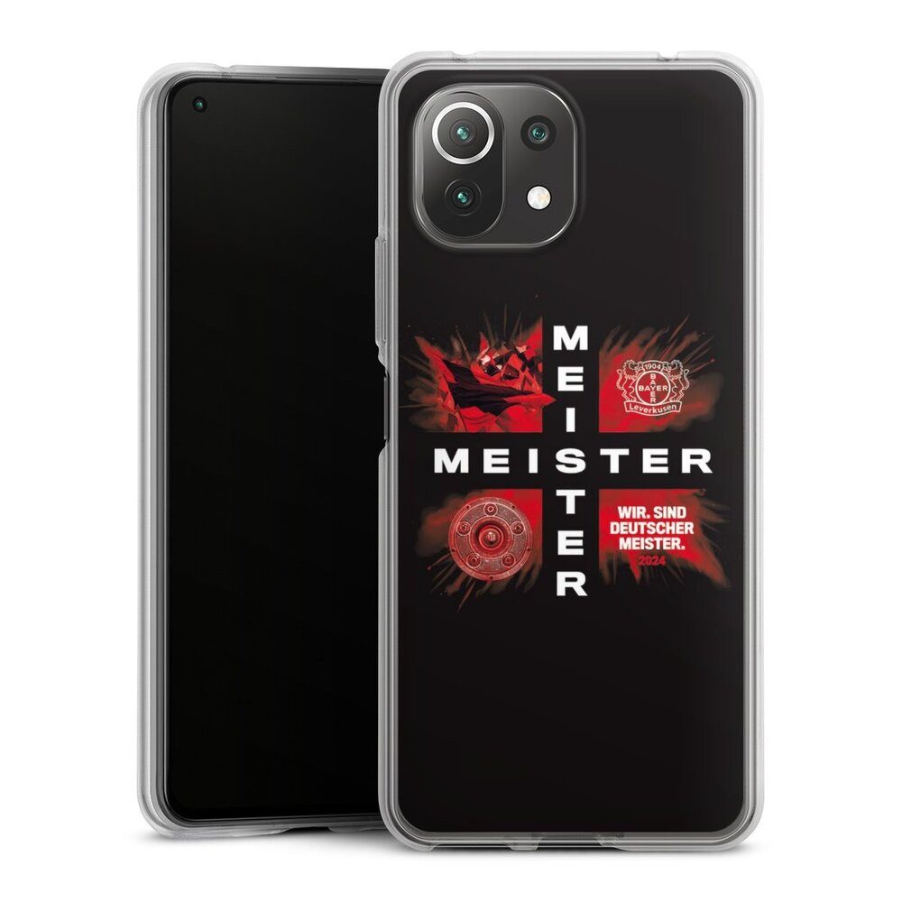 DeinDesign Handyhülle Bayer 04 Leverkusen Meister Offizielles Lizenzprodukt, Xiaomi Mi 11 Lite 5G NE Silikon Hülle Bumper Case Handy Schutzhülle