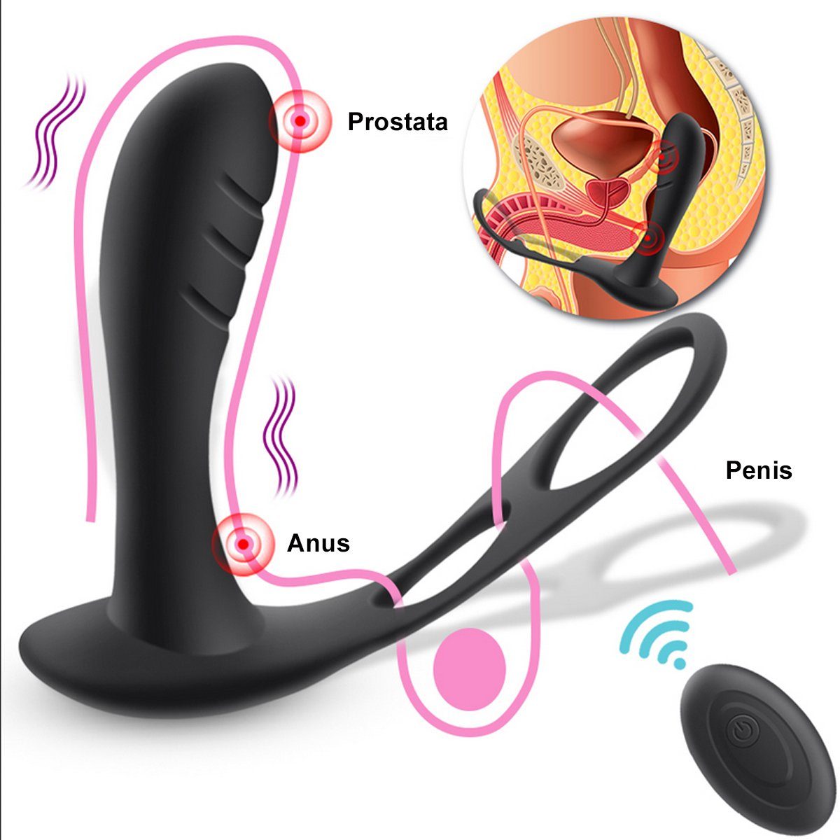 Remote Analvibrator Penisring ergonomischer USB - verschiedene und Vibrationsmodi wiederaufladbar, Prostata-Rotator 10 TPFSecret mit mit Prostata Hodenring, Control Stimulator über
