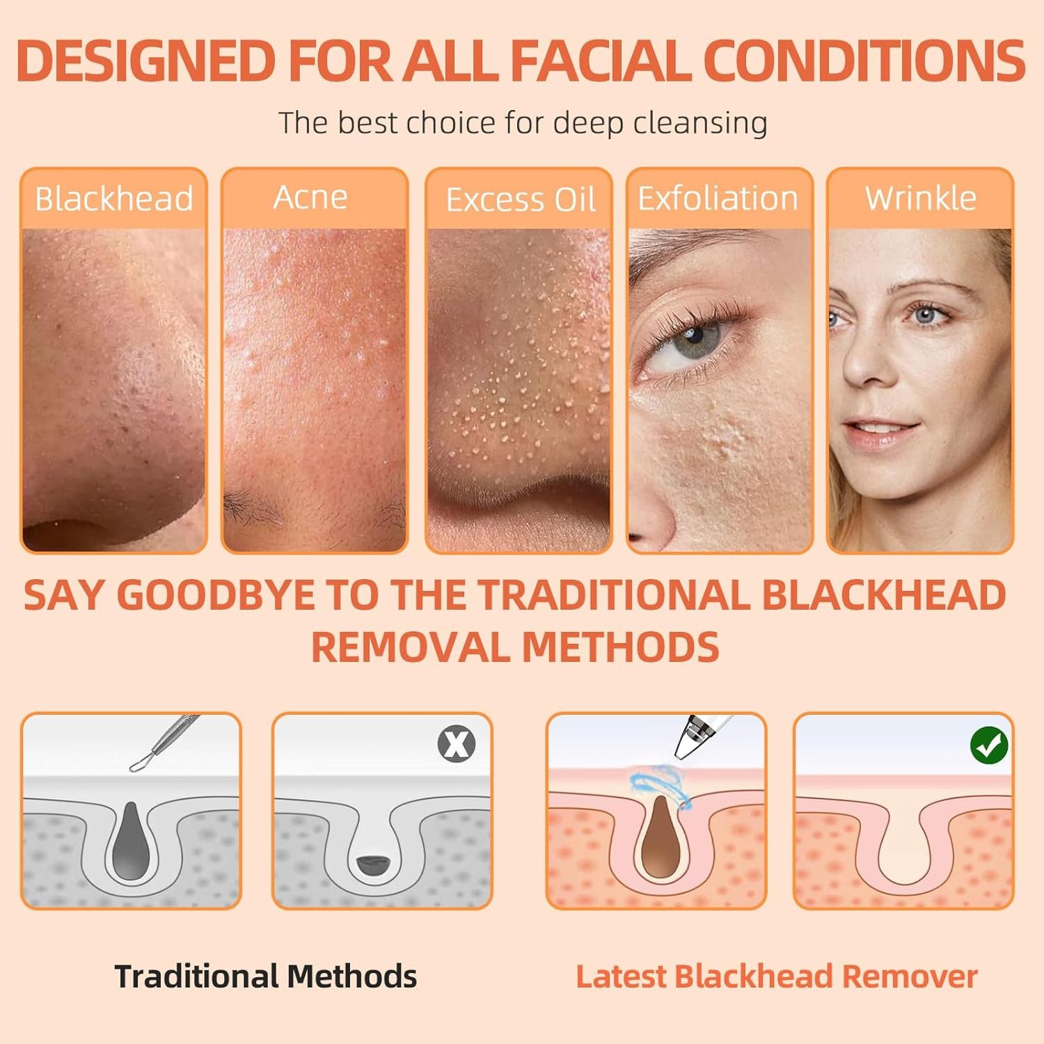 ibettertec Mikrodermabrasionsgerät Porenreiniger,Mitesserentferner,Porensauger,6 Saugköpfen, Gesichtsporenreiniger, Tiefenreinigung,USB-aufladbar, weiß,Komedonen-Extraktor,Geschenkset, Vakuum Beauty Hautpflegegerät mit 3 Modi,für Verschiedene Hauttypen