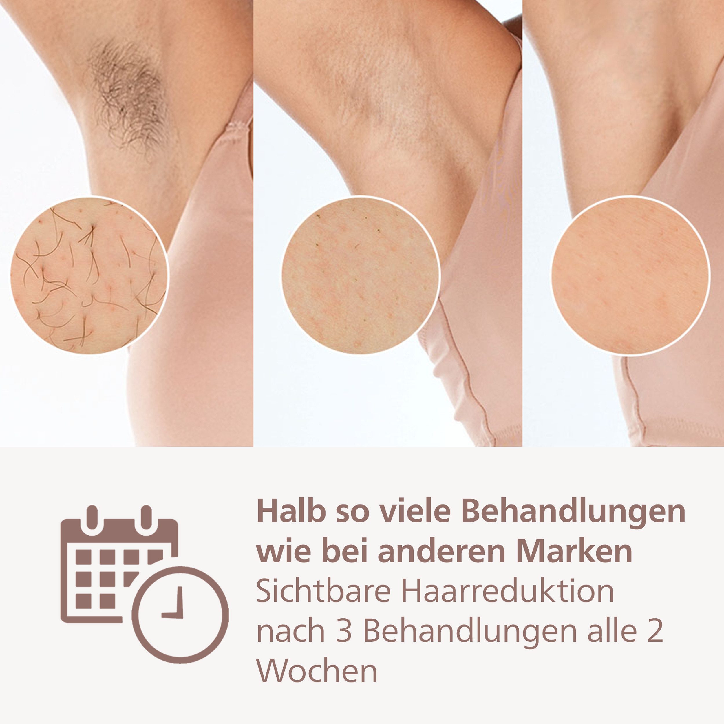 Philips IPL-Haarentferner Philips Lumea Series 9900 BRP959/00, 450.000 Lichtimpulse, 4 Aufsätze (Achseln, Bikinizone, Körper, Gesicht), 3 SkinAI Funktionen – Bild 5 von 5