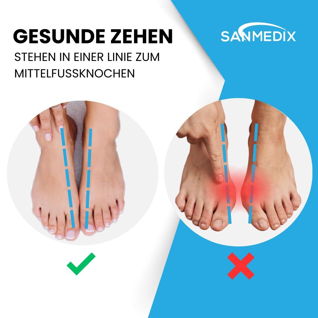 Sanmedix Zehenspreizer Silikon für Hallux Valgus Korrektur, Ballenzehen Zehenkorrektor, Set 4-tlg., Unisex