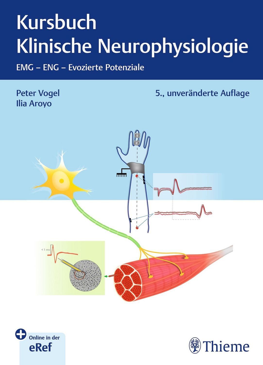 Kursbuch Klinische Neurophysiologie / Peter Vogel, Ilia Aroyo