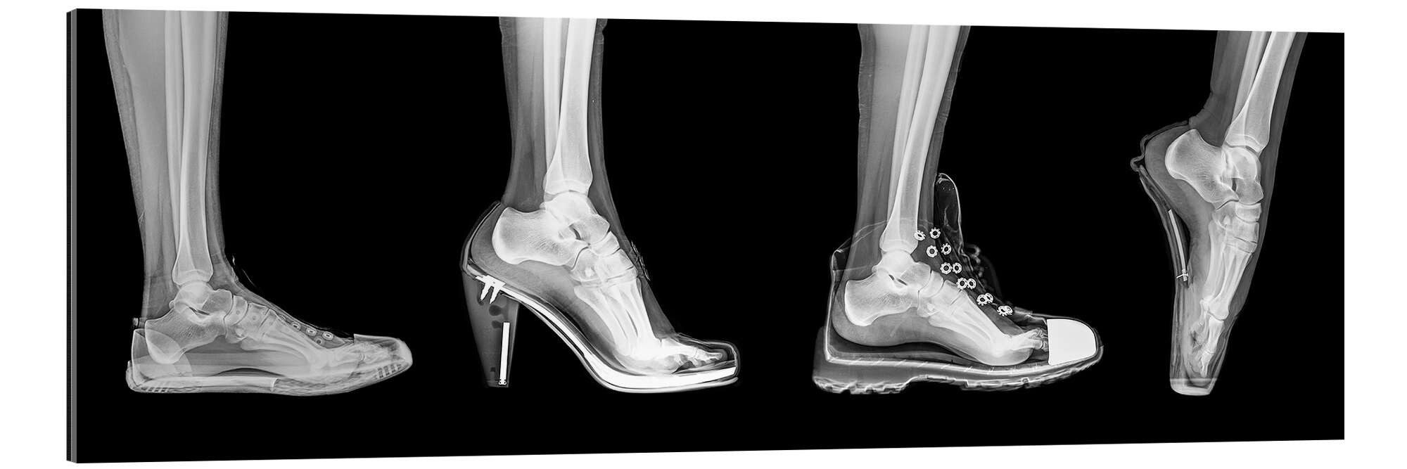 Posterlounge Wandbild Verschiedene Schuhe (Röntgenbild), Science Photo Library, erhältlich als Poster, Leinwandbild, Wandsticker oder Acrylglasbild