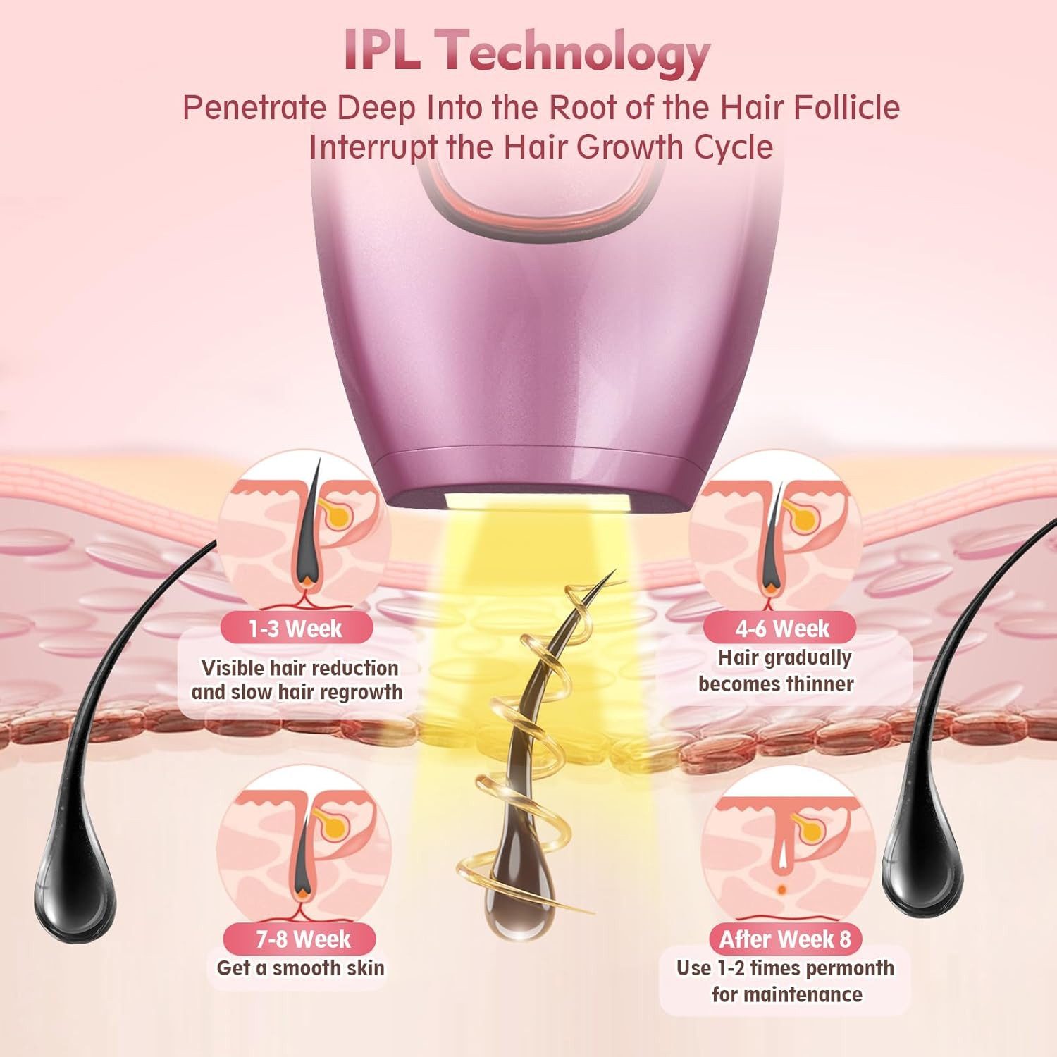 feinlux Ersatzscherköpfe Aufsatz Body Groomer Rasiere,Epilierer, Set, Mit integriertem sanftem LED-Licht und scharfen Edelstahlklingen, Haarentfernung, Hautverjüngung und Aknebehandlung 3-in-1