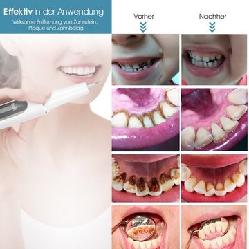 oyajia Zahnpflege-Set Zahnreinigung Set, Zahnreinigungsset für Pflege von Zahn Zu Hause, mit 5 einstellbare Modi und 3 austauschbare Reinigungsköpfe