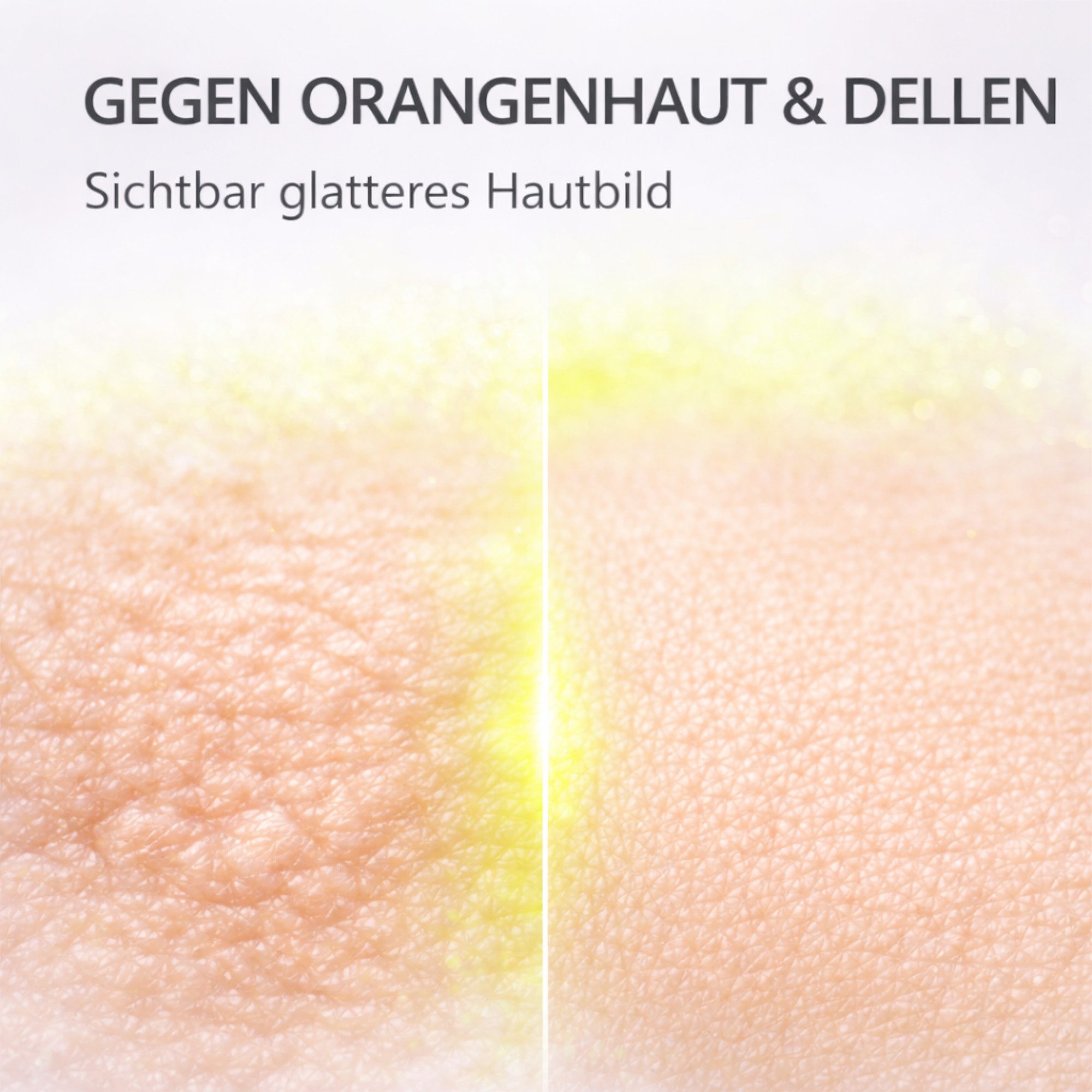 Matrixneedling™ Gesichtsserum Matrixneedling™ Cellulite Serum 5% Koffein–Anti Dellen Body Contouring