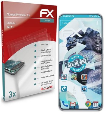 atFoliX Schutzfolie Displayschutzfolie für Xiaomi Mi 11, (3 Folien), Ultraklar und flexibel