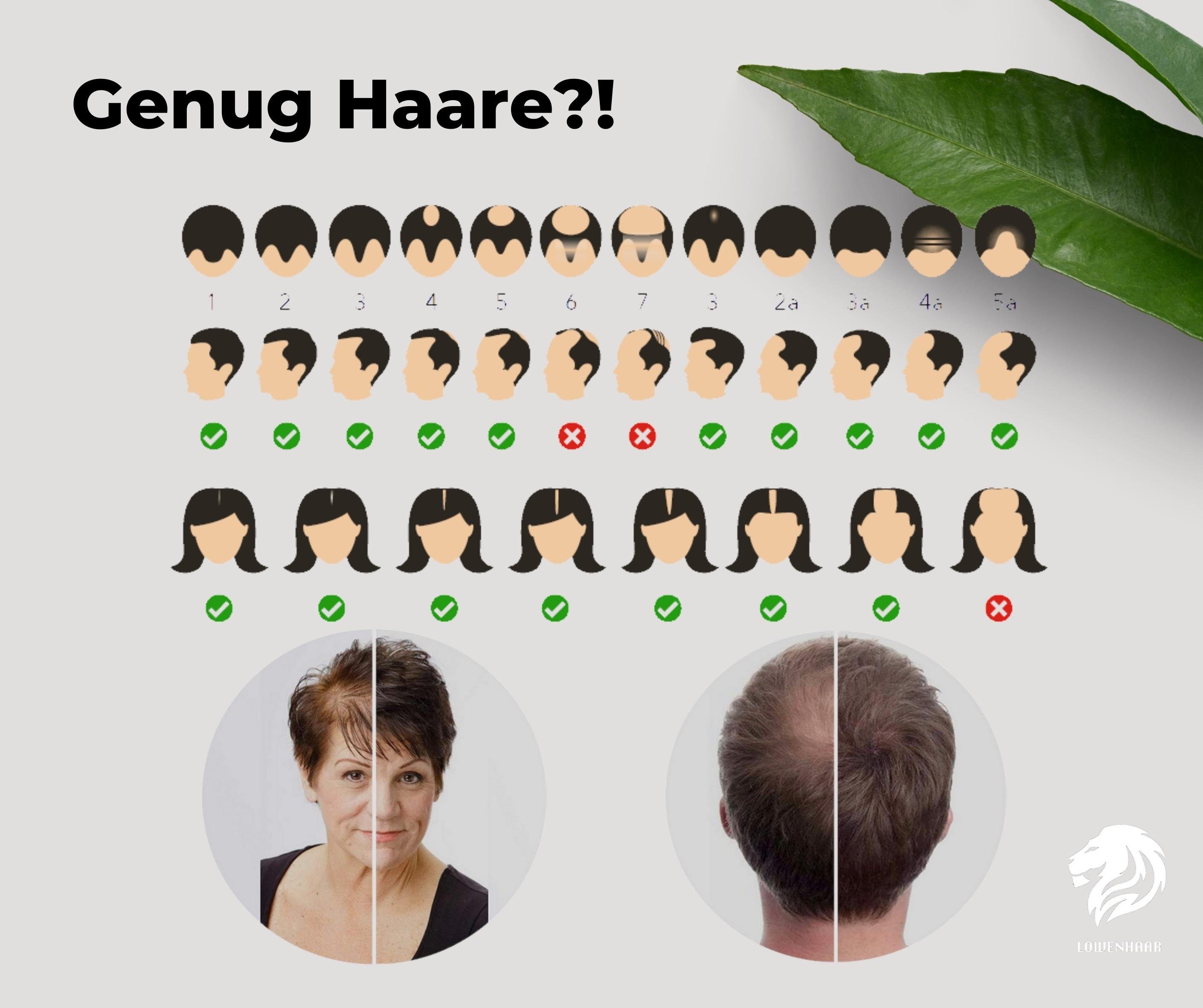 + Feines + 27,5 Streuhaar/Schütthaar/Hair Fixierspray Fibers Löwenhaar Sek, Haarverdichtung, 15 Haar, Kaschiert DarkBrown Löwenhaar Starterkit mit Kunsthaar-Extension ml g Haarpuder Premium Frauen/Männer in Applikator, für Haarausfall 118