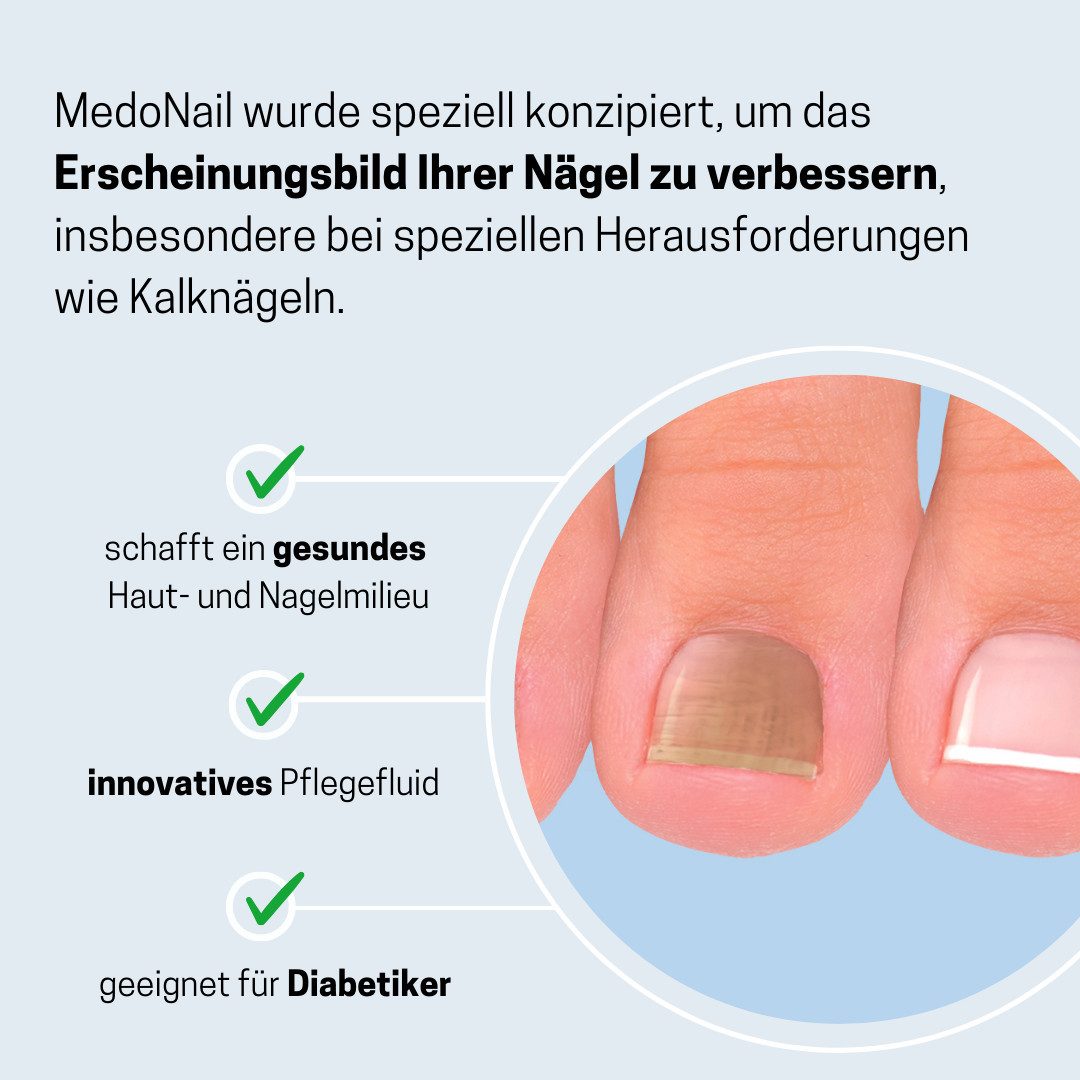 Medosan Nagelpflegeserum MedoNail bei Nagelpilz und Kalknägeln, zur wirkungsvollen und langfristigen Behandlung von Nagelpilz