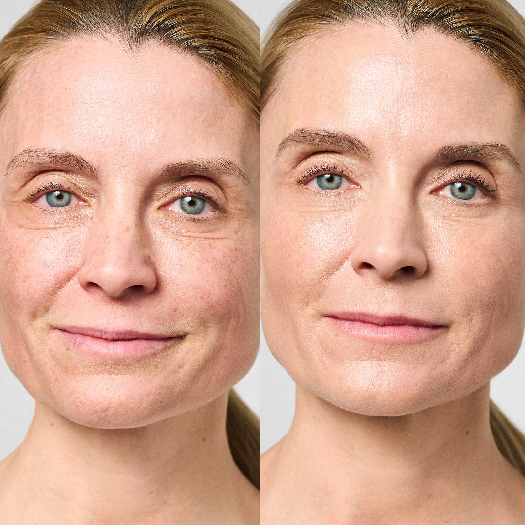 asambeauty Gesichtsserum Mimic Booster Anti-Mimikfalten-Serum