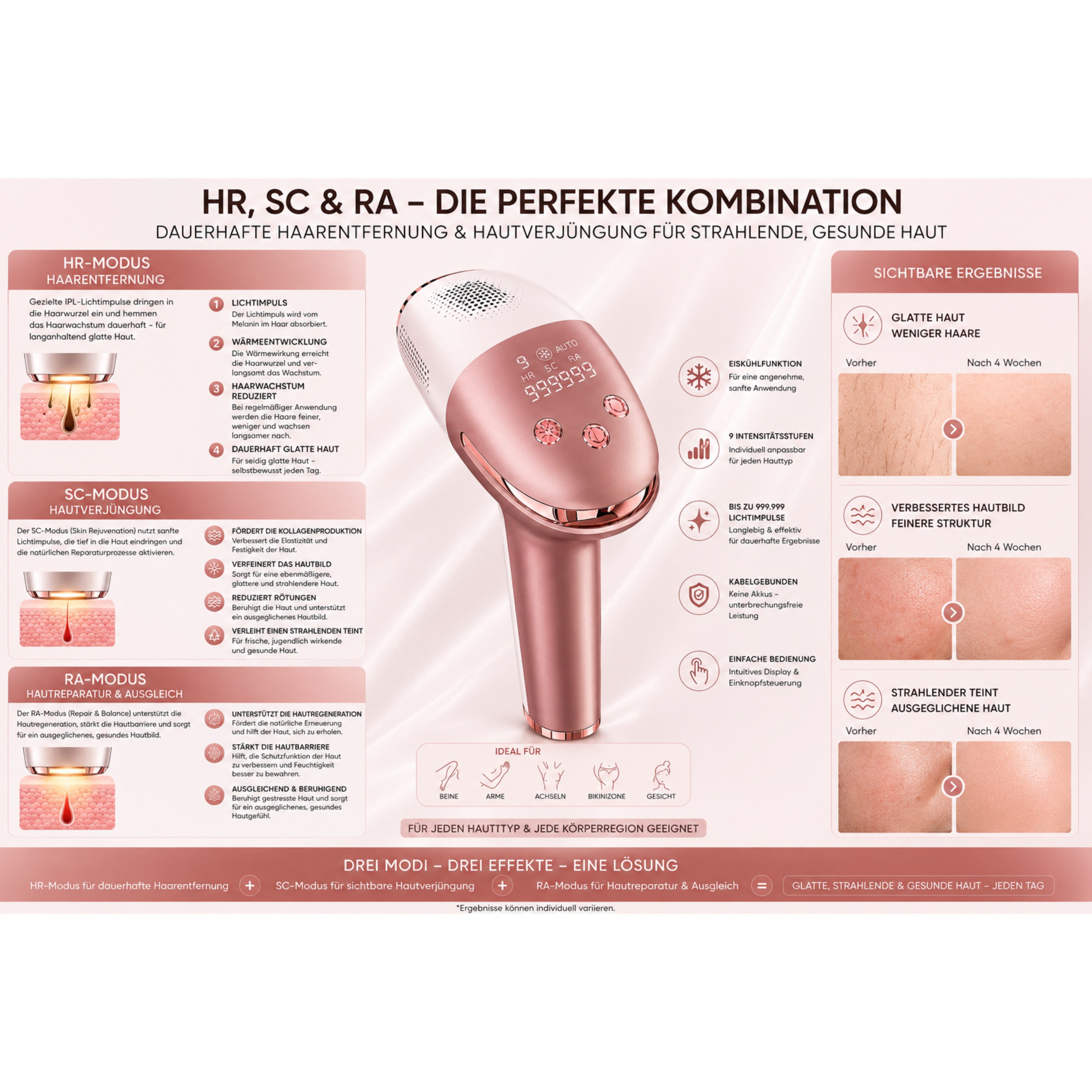 Lalano`S Cosmetics IPL-Haarentferner IceSilk Pro mit Eiskühlfunktion, HR/SC/RA & Auto-Modus, 999.999 Lichtimpulse, 9 Intensitätsstufen