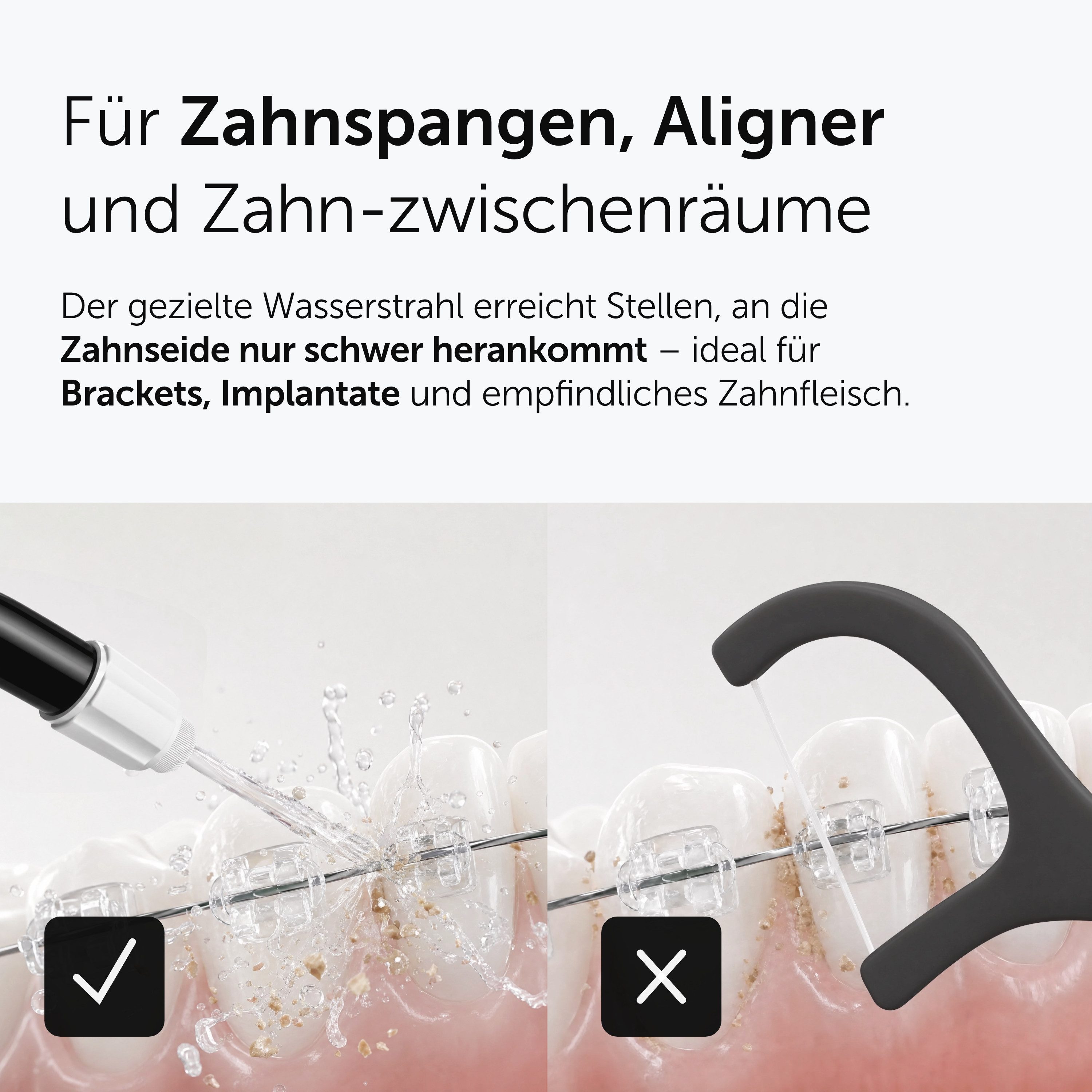 Wondersmile Munddusche Testsieger 2026 - 100 Tage risikofrei testen - SmoothFlow-Technologie, Aufsätze: 1 St., Inteligentes OLED Display – Bild 5 von 5