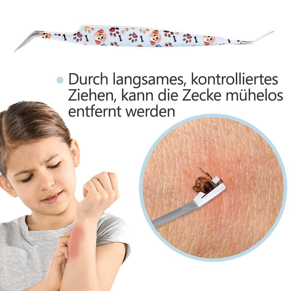 Helperfect Zeckenpinzette