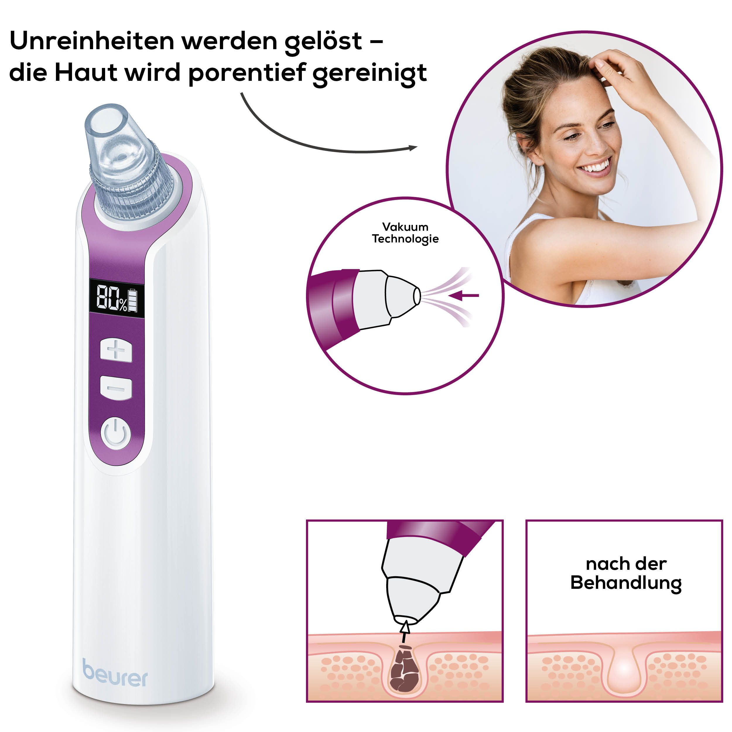BEURER Porenreiniger FC 41 Mitesserentferner durch Vakuumtechnologie, 5 Intensitätsstufen und 3 Aufsätze für eine individuelle Anwendung