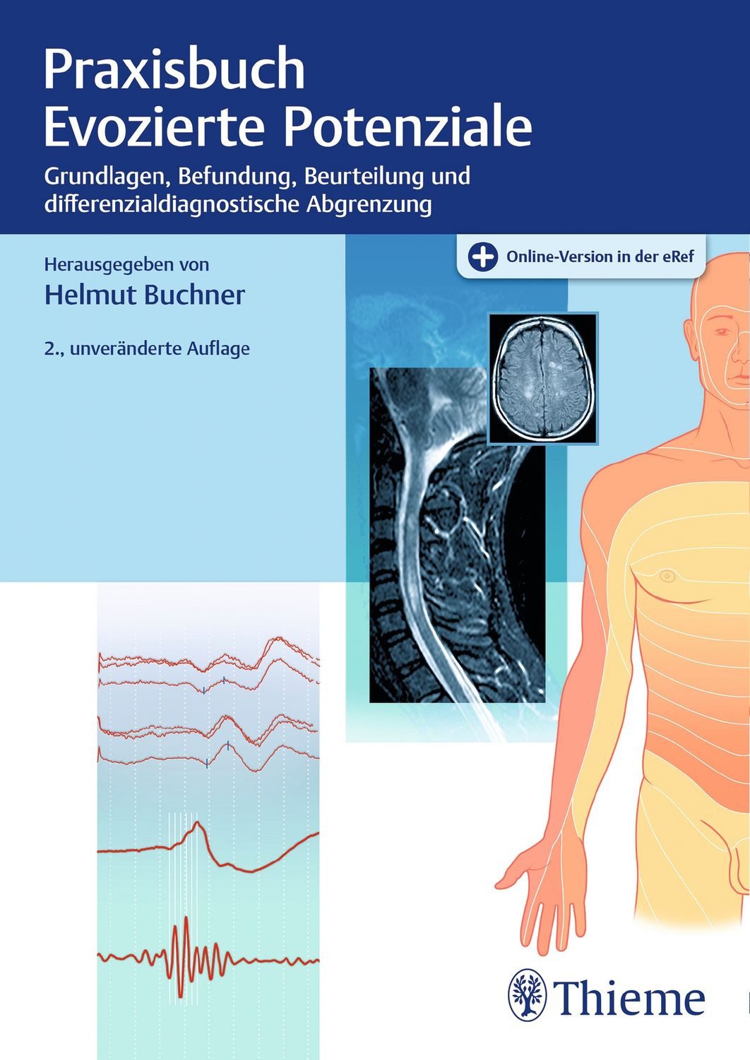 Praxisbuch Evozierte Potenziale Grundlagen, Befundung, Beurteilung und / diverse, Grundlagen, Befundung, Beurteilung und differenzialdiagnostische Abgrenzung