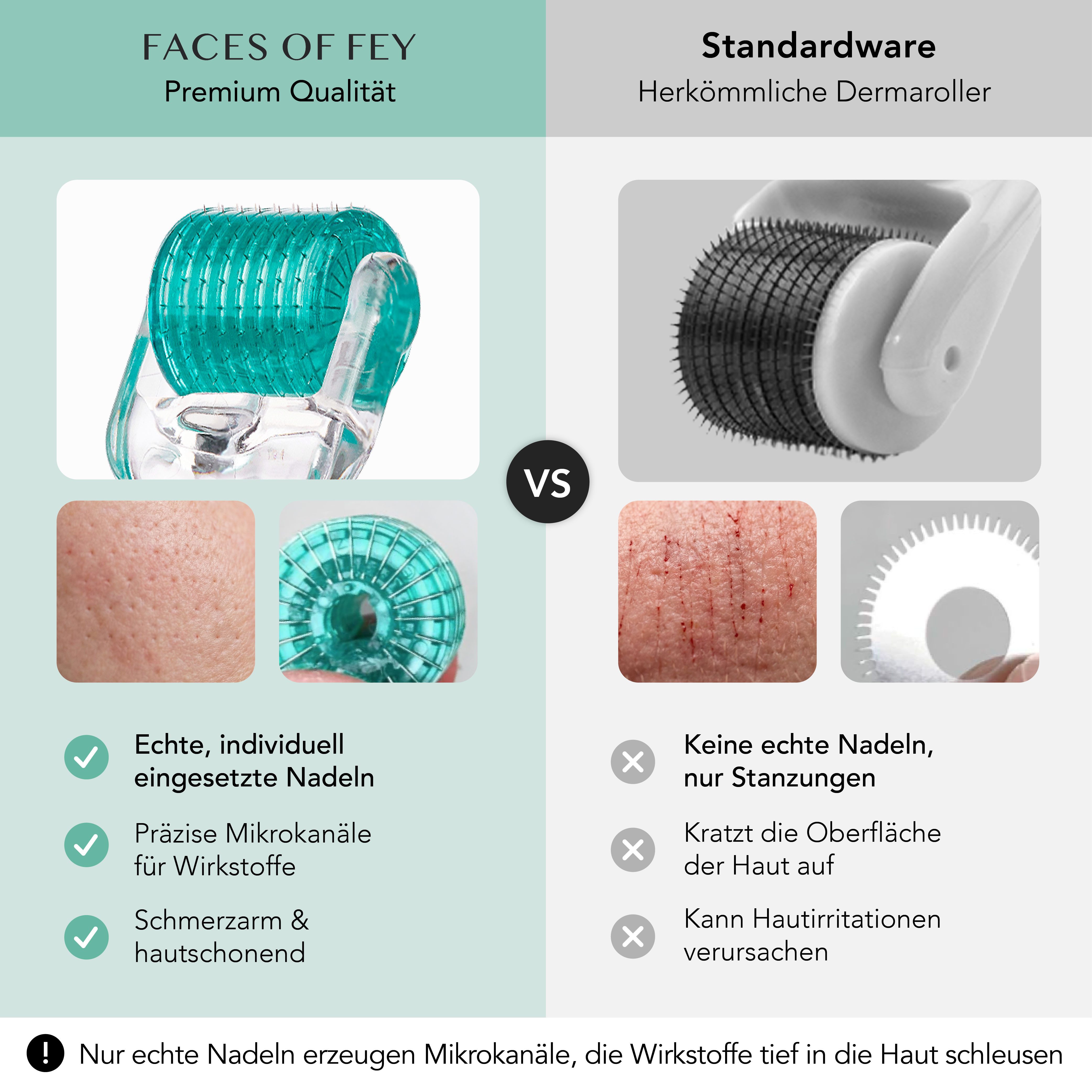 FACES OF FEY Dermaroller 192 ECHTE Nadeln