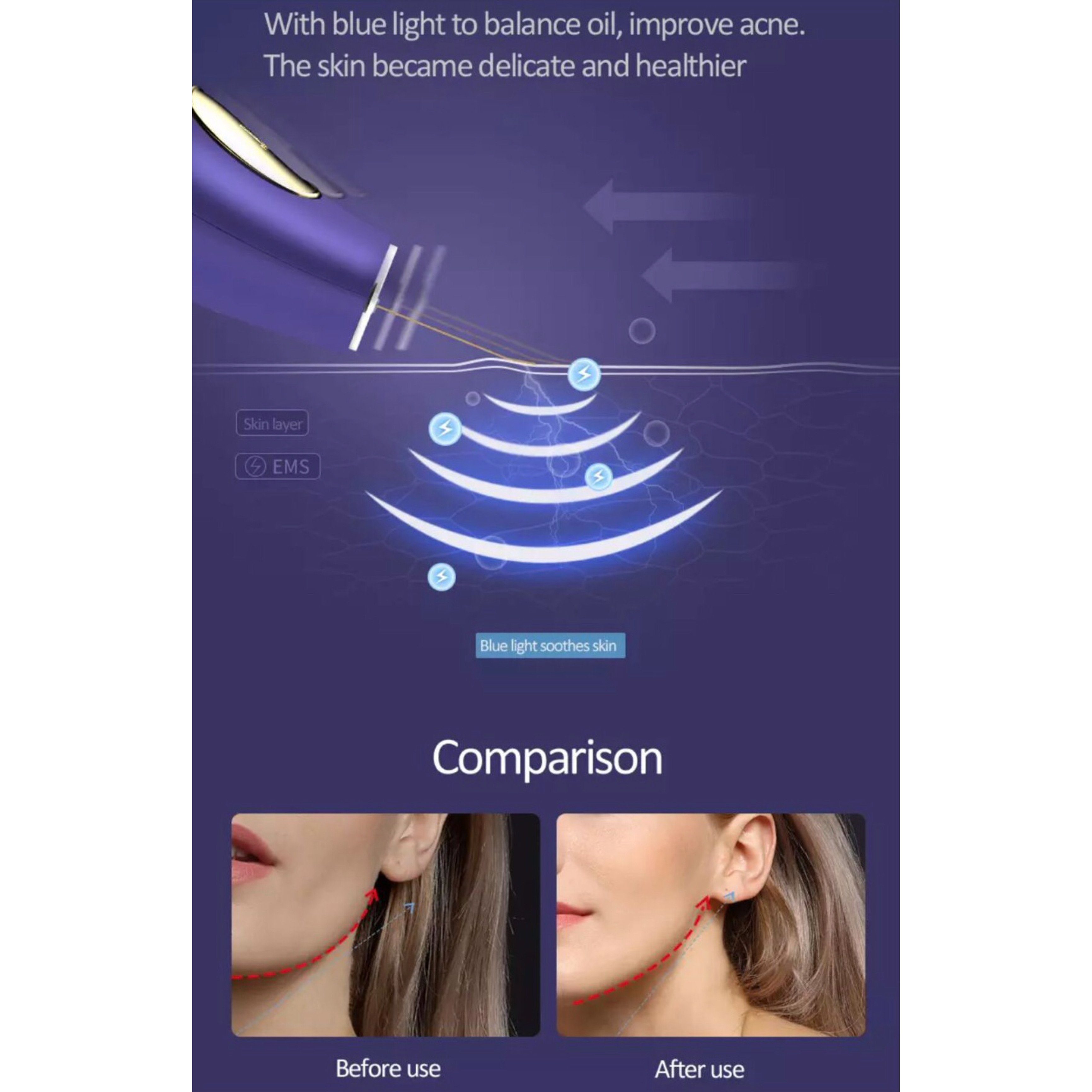 FOREO LUNA Go – Kompaktes Gesichtsreinigungsgerät Mit Anti-Aging, Wasserdicht, Für Unterwegs