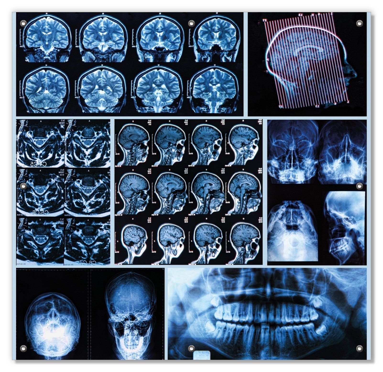 Sonnenschutz Röntgen-Bilder eines menschlichen Kopfes von allen Seiten, Wallario, blickdicht, mit Saugnäpfen, wiederablösbar und wiederverwendbar