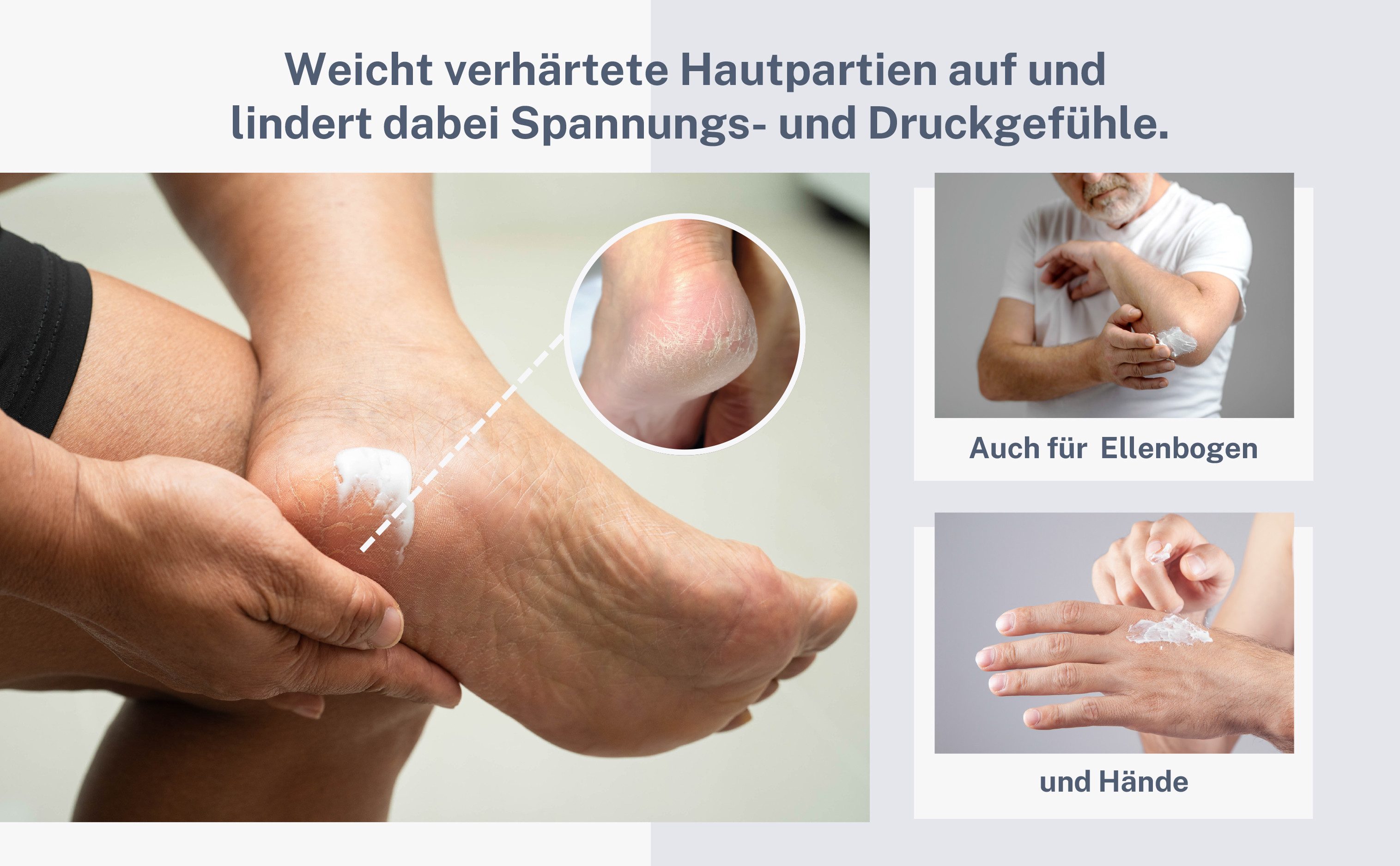 Hydas Hornhautbalsam DermaAktiv Pflegebalsam zur Hornhautreduktion für raue Hautpartien, 75% Hornhautreduzierung in 28 Tagen, auch für Diabetikerhaut geeignet
