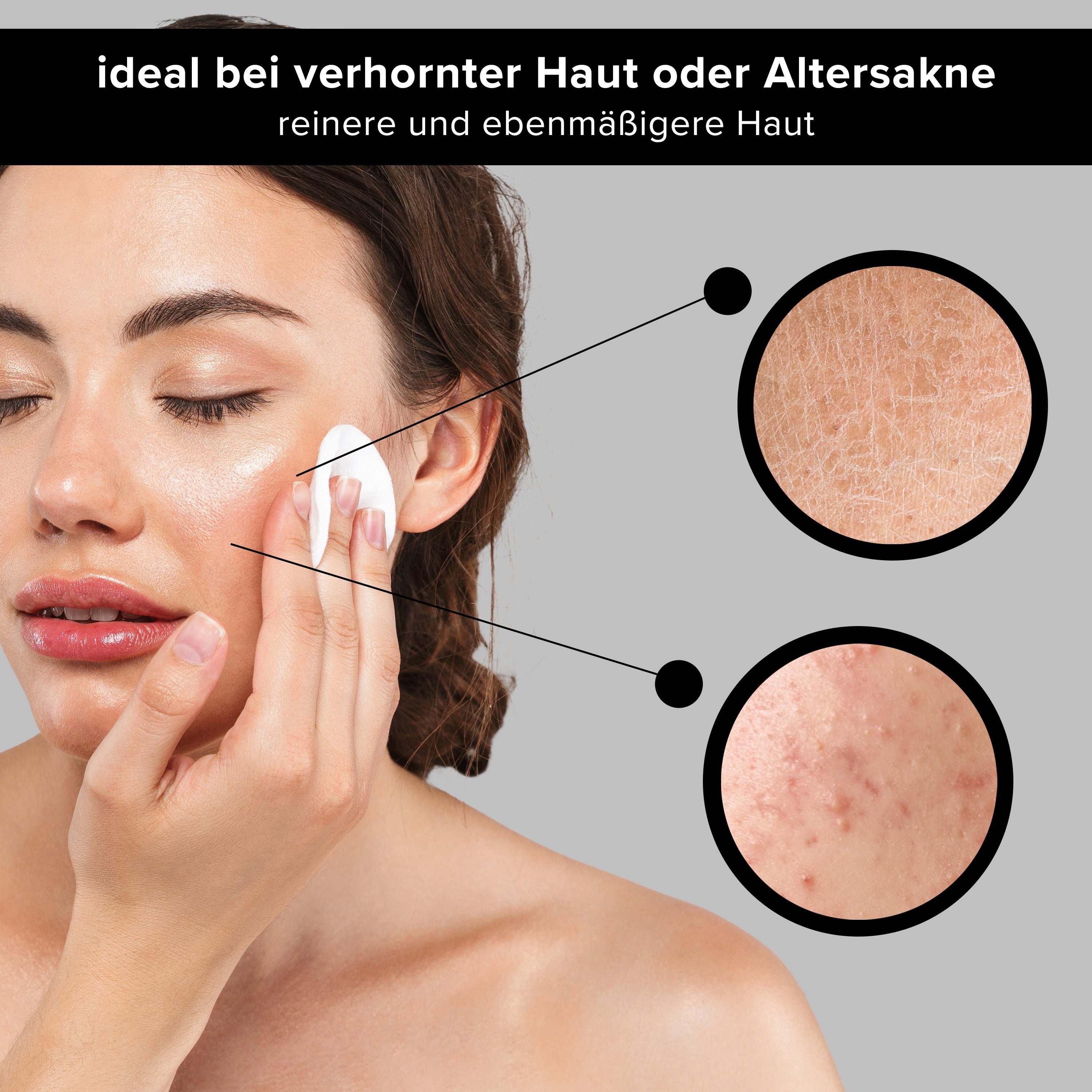 RAU Cosmetics & AHA Gesichtsreinigung Gesichtswasser - Gesichtsreinigung Toner Unreinheiten Poren, gegen Fruchtsäure