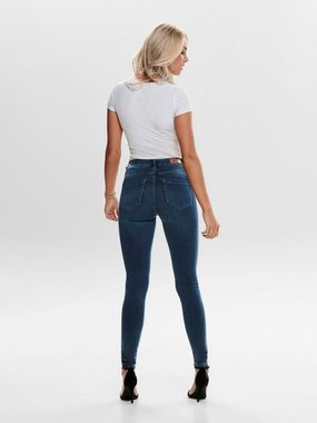 ONLY High-waist-Jeans ONLROYAL