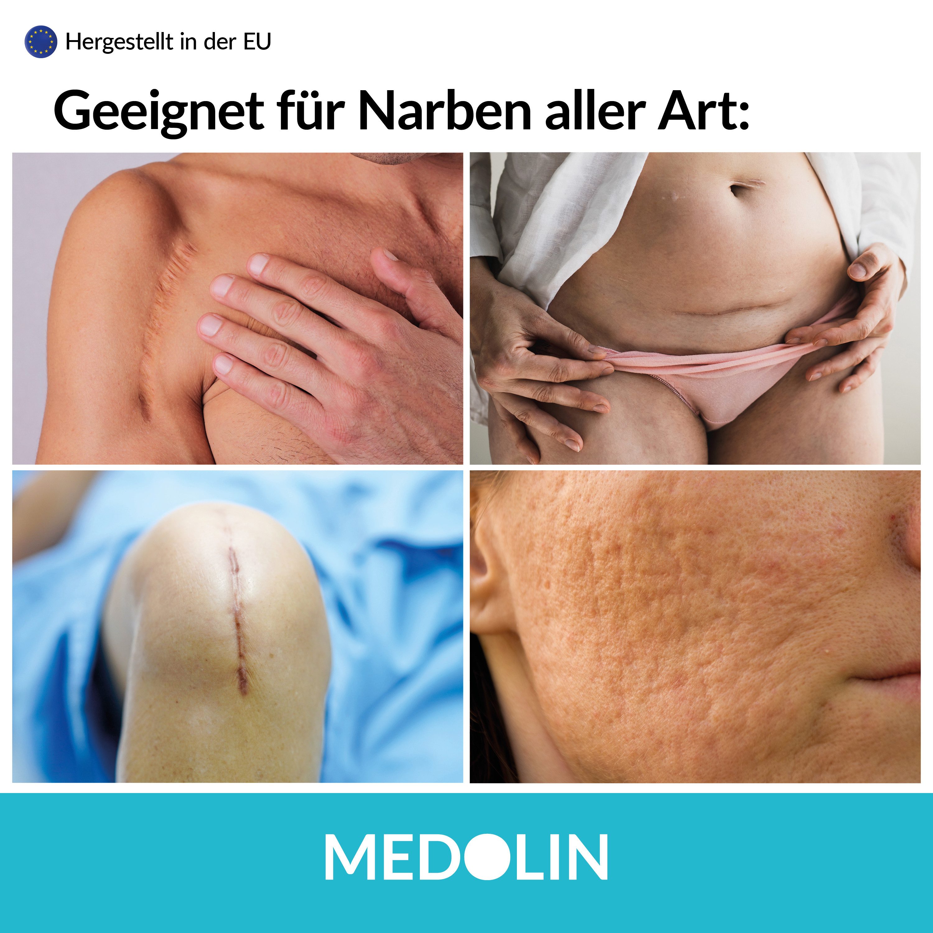 Medolin Hautpflegegel Narbengel - Effektive Narben Creme - Narbensalbe für schöne Haut, 1-tlg.