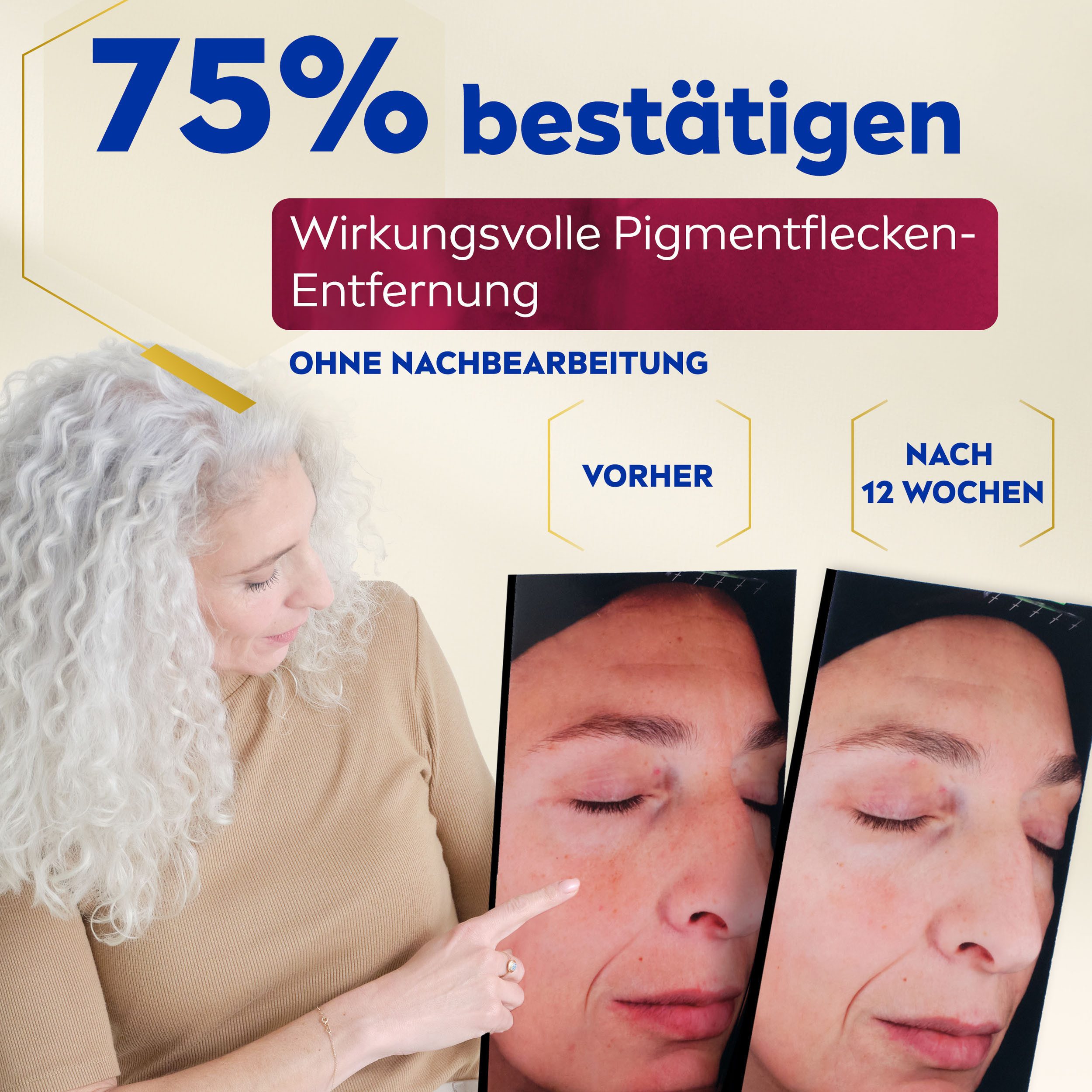Nivea Gesichtsserum LUMINOUS630 ANTI-PIGMENTFLECKEN Intensiv-Serum, Mit Thiamidol und Hyaluronsäure, auch für sensible Haut geeignet.