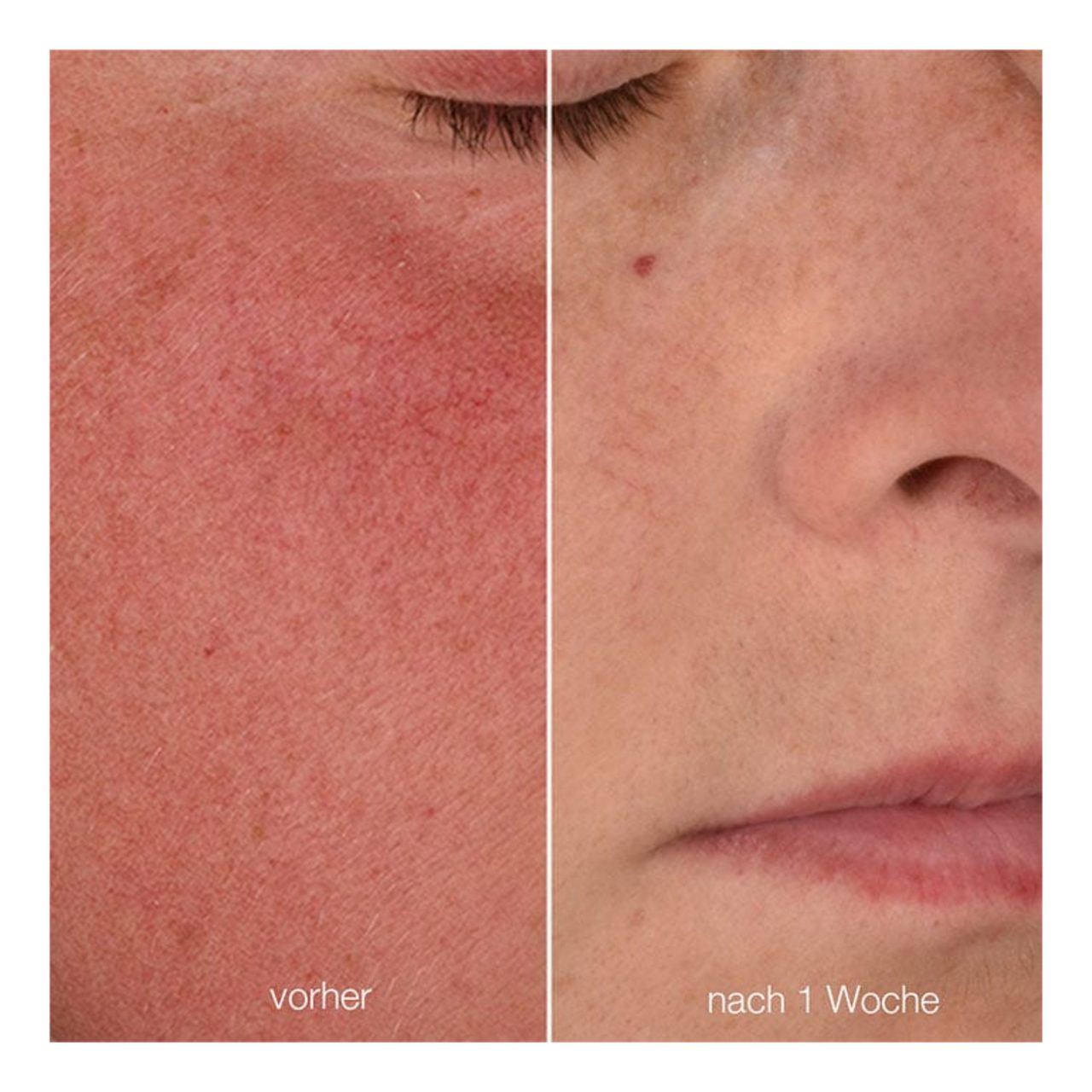 Dermalogica Tagescreme Stabilizing Repair Cream, für empfindliche Haut