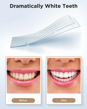 Silberstern Zahnpflege-Set Zahnaufhellungsstreifen, 28 Sensitive-Free-Aufhellungsstreifen, Peroxidfrei, entfernt Kaffee-, Tee- und Zigarettenflecken