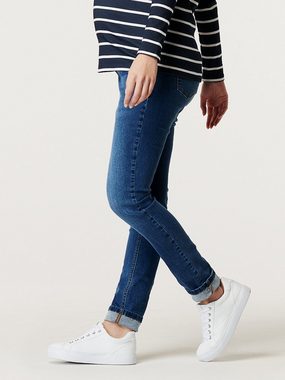 ESPRIT maternity Umstandsjeans Skinny Umstandsjeans (1-tlg)