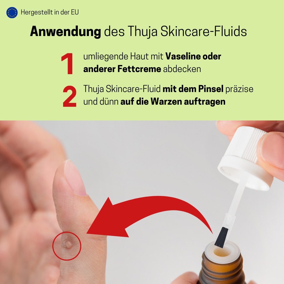 Medosan Warzen-Behandlungsstift Thuja Skincare-Fluid, 10ml mit Dosierpinsel, schnelle Entfernung lästiger Warzen