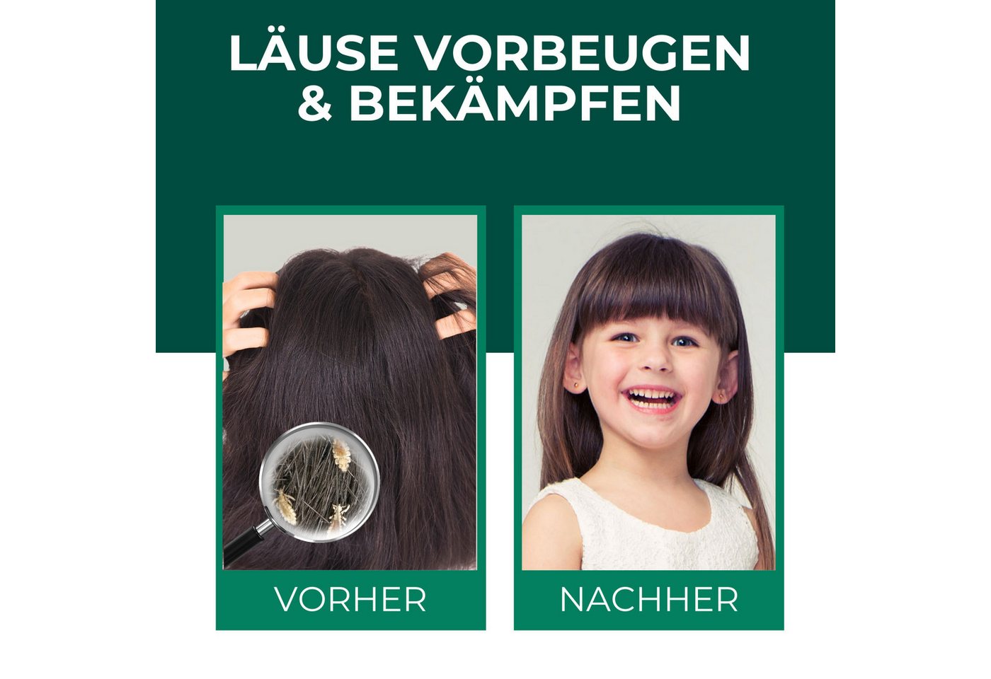 Thumbnail - Silberkraft Insektenspray Silberkraft Kopfläusespray Effektiver Läuseschutz für Kopfhaut & Haare, 100 ml, 4-St., Läuse z...