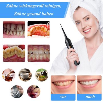 FeelGlad Schall-Zahnreinigungsgerät Zahnreinigung, Wiederaufladbar