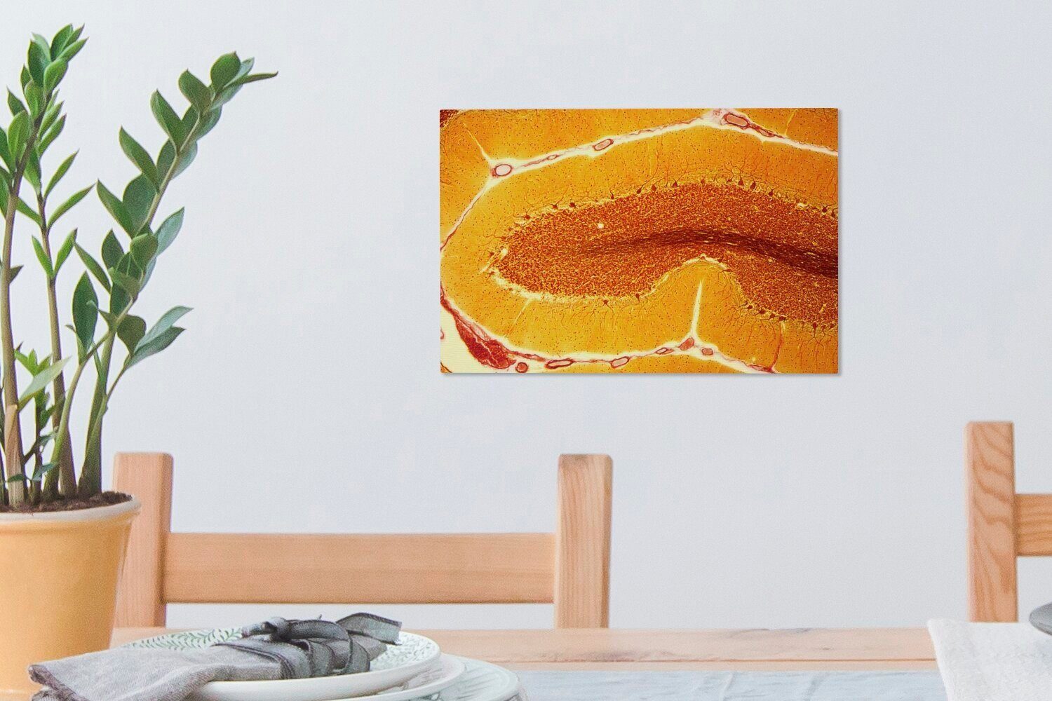 OneMillionCanvasses® Leinwandbild Orangefarbene Zellen Wandbild Leinwandbilder, Wanddeko, einem Nerv, 30x20 cm in St), Aufhängefertig, (1