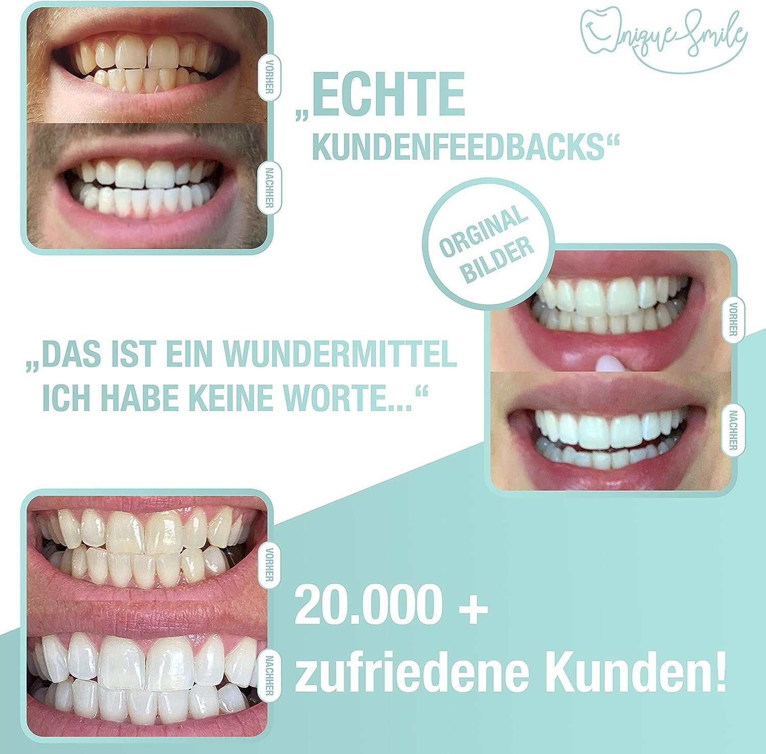 Uniquesmile Zahnbleaching-Kit Testsieger - 100 tage risikofrei testen - Teeth whitening kit, PAP Formel, LED Technologie, schmerzfrei, frei von Schadstoffen.