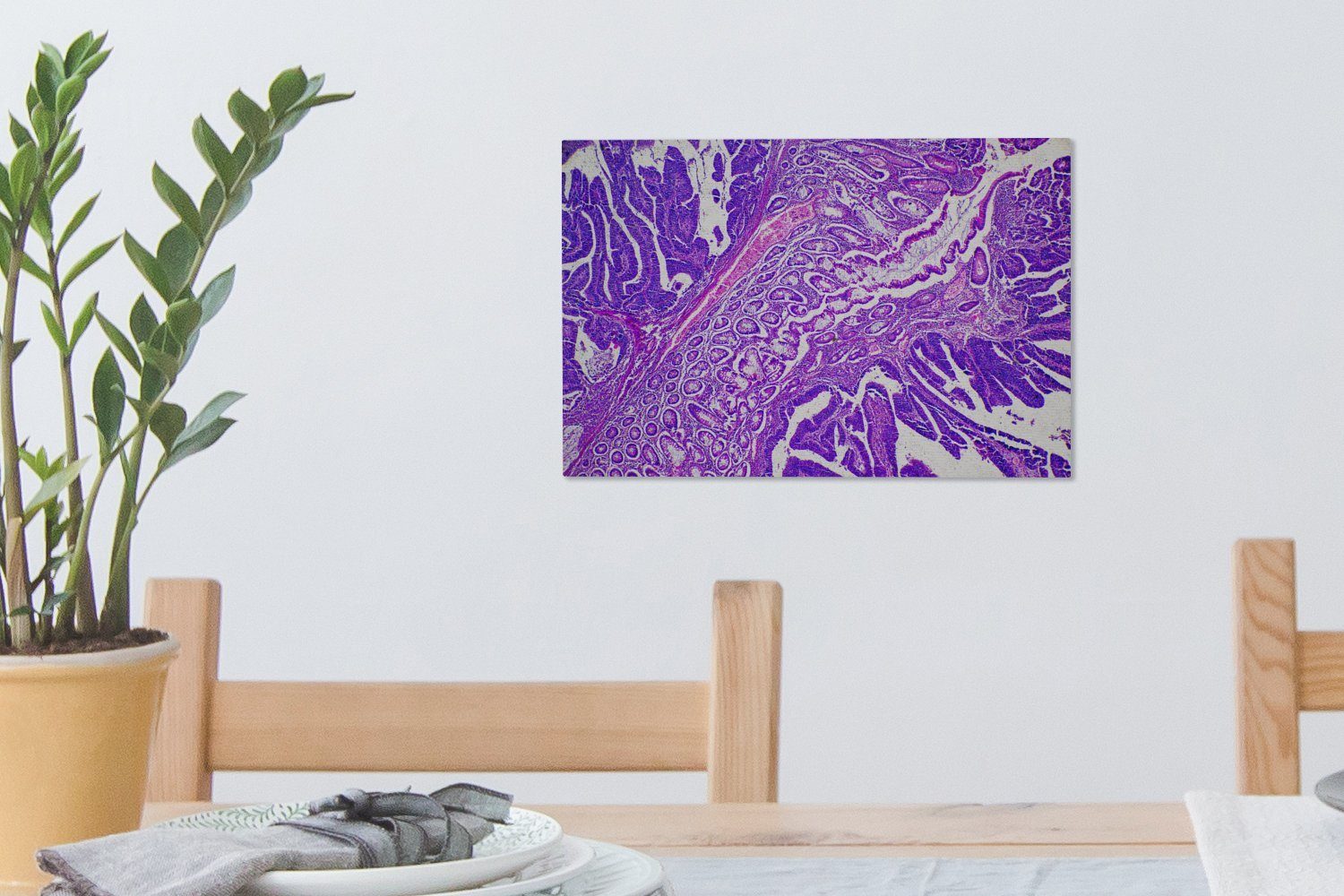 OneMillionCanvasses® Leinwandbild Bakterien, (1 St), Aufhängefertig, Wandbild Leinwandbilder, Wanddeko, 30x20 cm