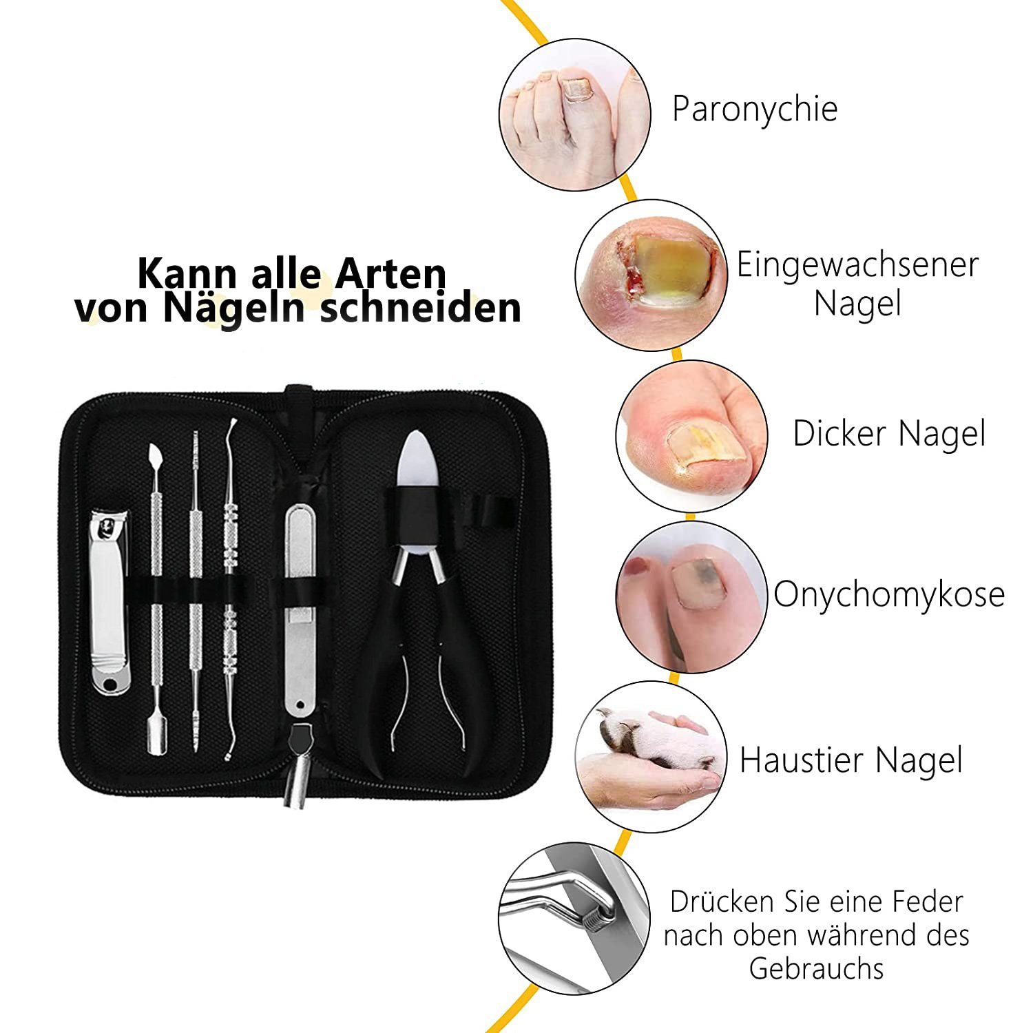 COOL-i ® Nagelprobleme Tasche, Nagelknipser-Set, 6-tlg., entwickelt für Edelstahl, 6-tlg