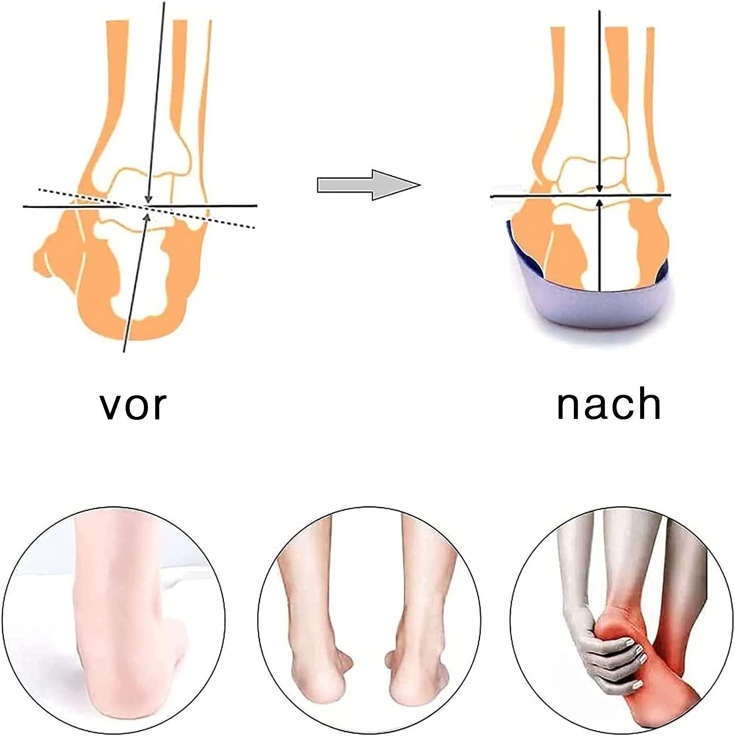 COOL-i ® Einlegesohlen Orthopädische Fersensporn-Einlegesohlen,1 Paar TPR-Dämpfungseinlagen, bei Plattfuß, Plantarfasziitis & Überpronation – Bild 4 von 5